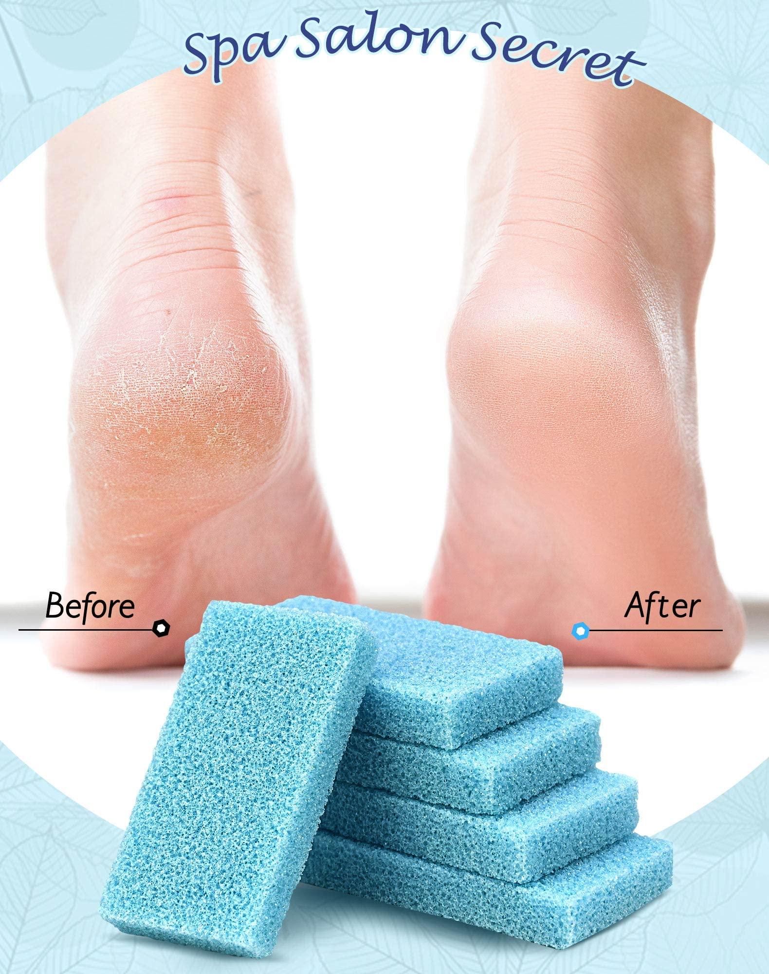 MARYTON Maryton Disposable Foot Scrubber Pumice Pads, Pedicure Pumice Stone Dead Skin Callus Remover for Feet, 40Pcs (Blue Medium Coarse)