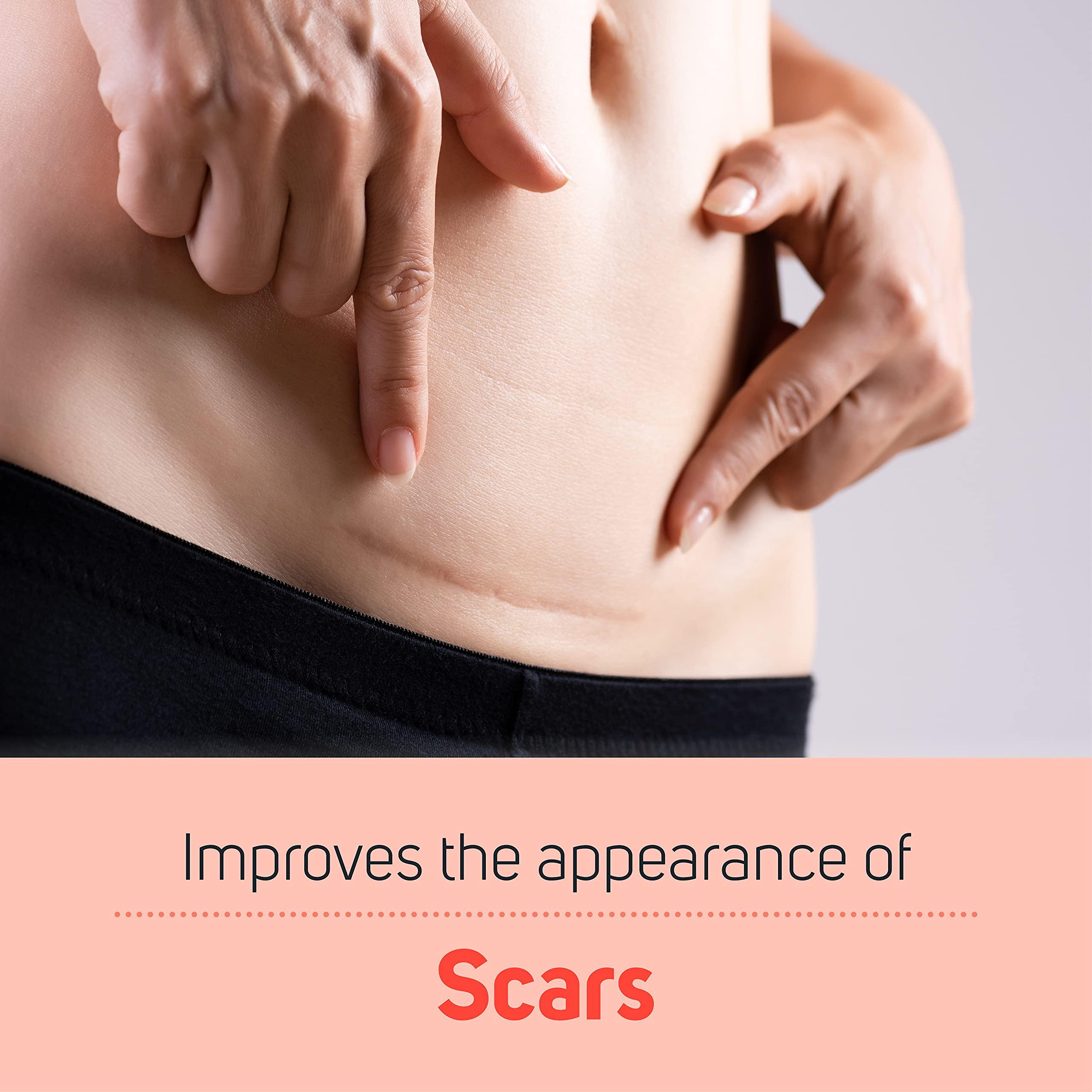 Care Science Care Science Stretch Marks + Scars Skin Care Body Oil, 5 OZ | For C Section Recovery, Scars, Stretch Marks, Hair, Aging, Dehydrated Skin | Natural Ingredients, Vitamin E Oil, Olive Oil, Coconut Oil