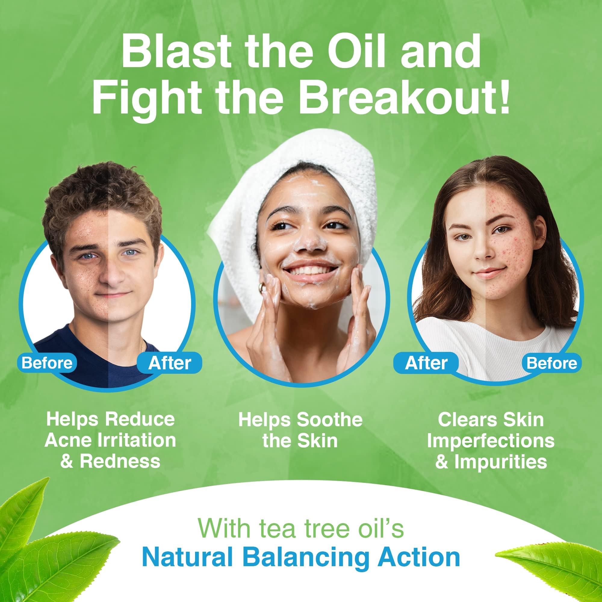 Kidskin Kidskin T-Blast Facial Cleanser, Gentle Face Wash with Tea Tree Oil, Spot Skin Care for Kids and Teens, Non-Drying Natural Cleanser for Oily or Dry, Acne-Prone Skin, 150 ml 5.0 fl oz.