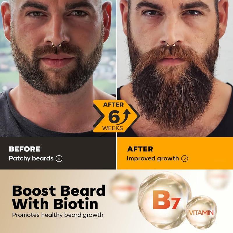 Waking Forest Waking Forest Beard Growth Kit, Luxury Beard Care Kit for Men, Beard Oil (2oz),Beard Wash and Conditioner,Beard Balm,Beard Comb, Beard Grooming Kit for Patchy/Scraggly Beard, Birthday for Dad Husband