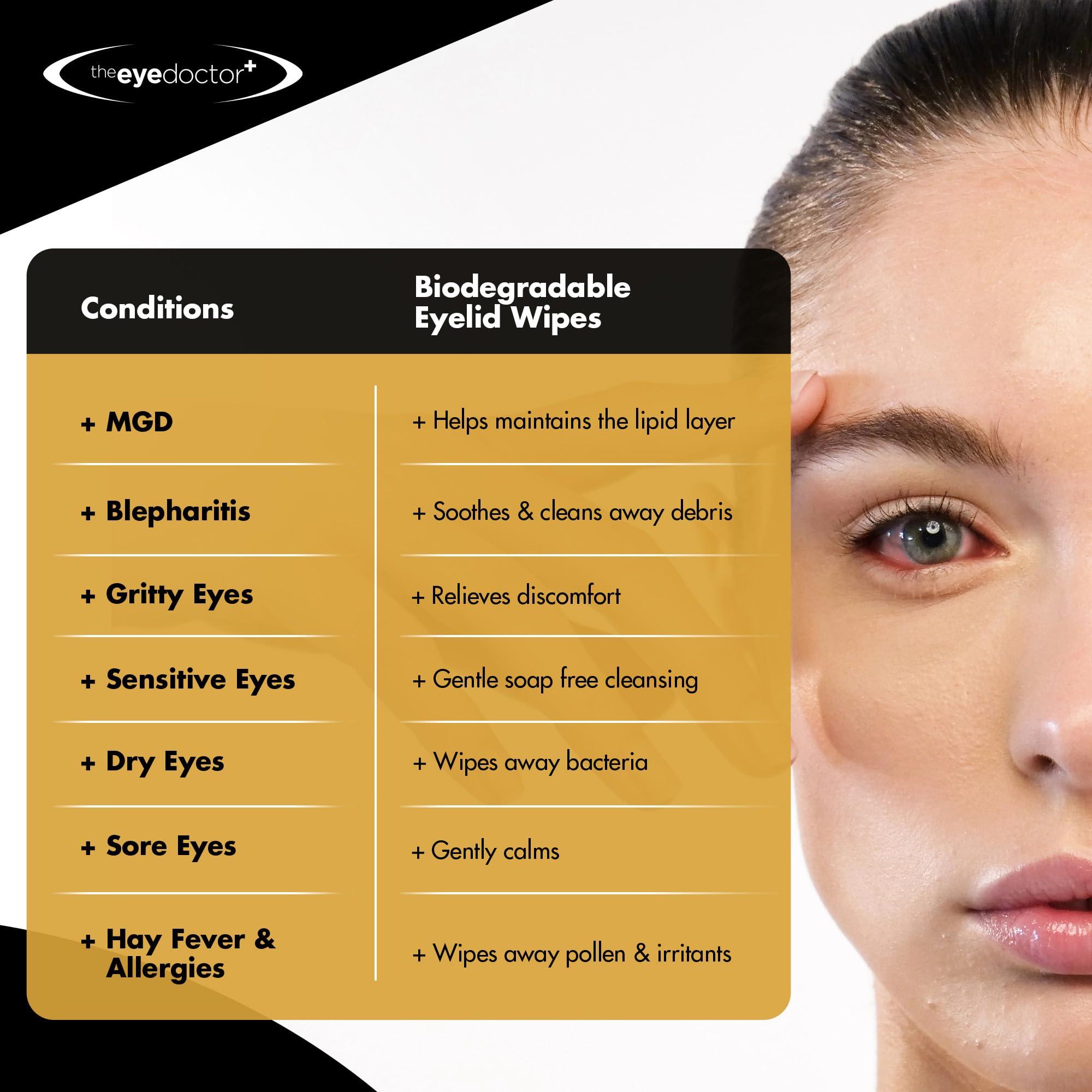 The Eye Doctor The Eye Doctor Eyelid Wipes  80 x Single use Lid & Lash Wipes  Suitable for Sensitive Eyes, Dry Eyes, Blepharitis & MGD - Rinse-Free Eye Wipes - Removes Makeup, Oil, Debris