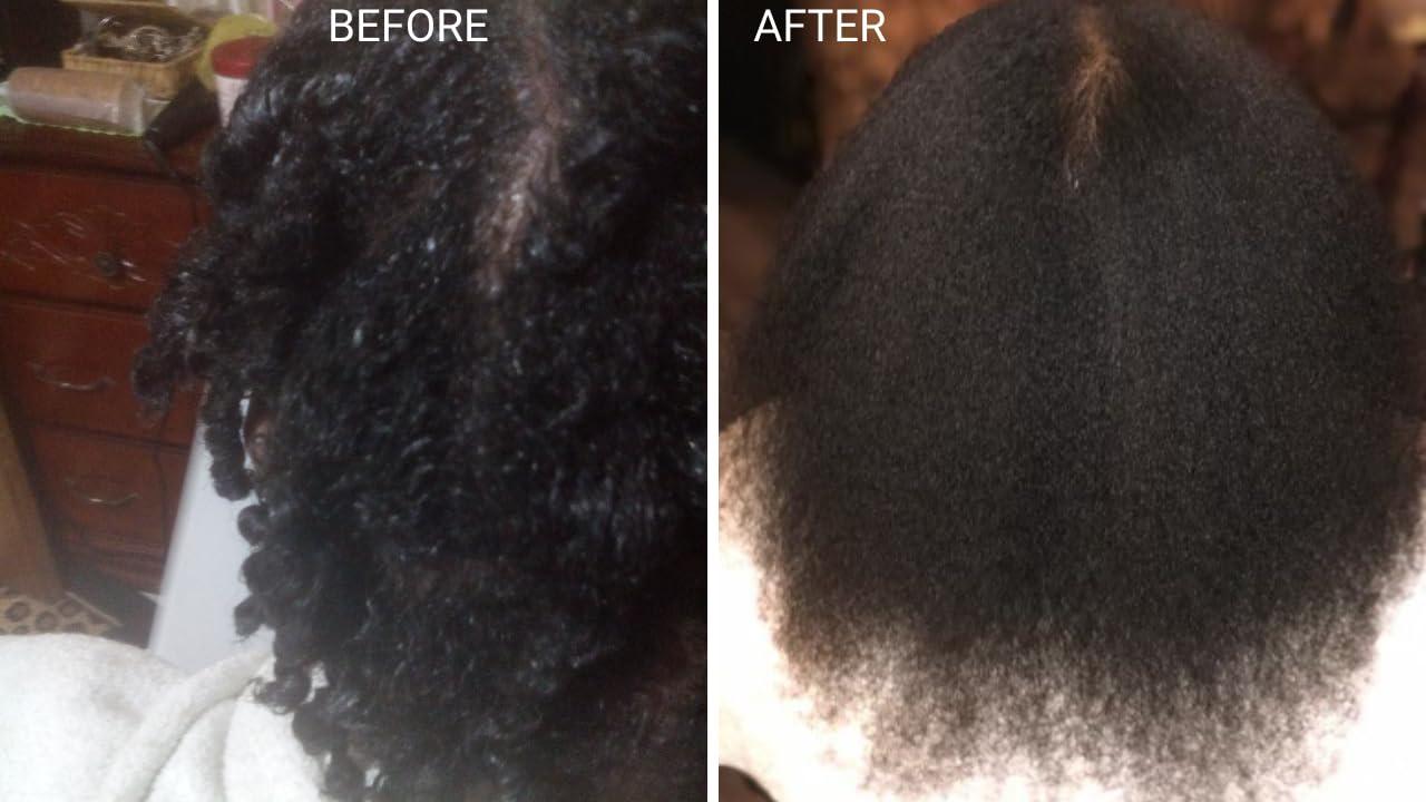 Generic Generic Ayurvedic Scalp Oil for Dandruff, Eczema, Hair Growth, 30+ Herbs, Roots, Oils, Green