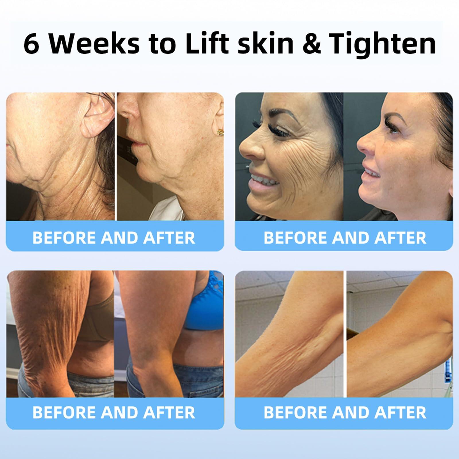 flysmus Aeehfengf Firm Tighten Skin Tighten Cream, Aeehfengf Skin Firming Cream, Aeehfengf Skin Firming Protein Cream, Skin Firming Rejuvenating Serum - 100ml (4PCS)