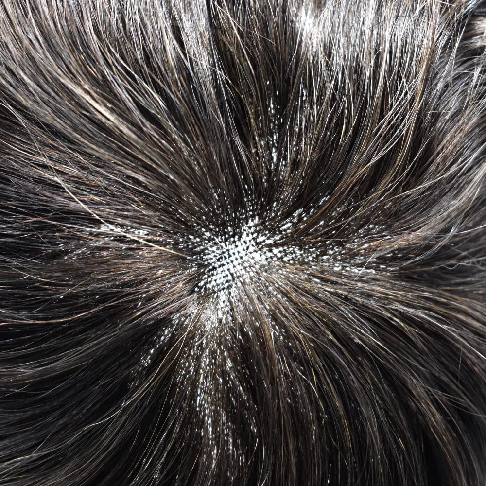 Generic Mens Toupee French Lace Hair Replacement System For Men Hairpieces Toupee For Men Hair System Hair Piece For Men Natural Hairline 8x10 Light to Medium density 3# DARK BROWN