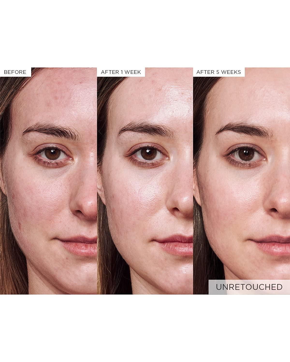 Glow Recipe Glow Recipe Avocado Ceramide Serum - Soothing, Hydrating Face Serum for Women & Men, Redness Relief & Skin Barrier Repair - Lightweight, Milky Korean Skincare for Dry, Sensitive Skin (30 ml)