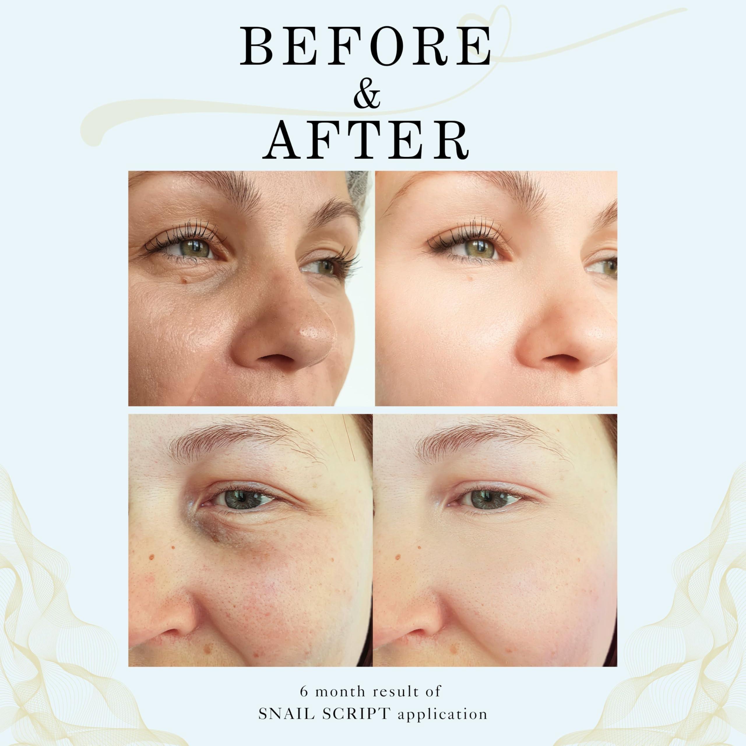 Sparta The Power of Beauty Sparta The Power of Beauty Snail Script Face Serum, Wildcraft Botanical Anti Aging Serum, Repair Skin Serum with Peptides and Vitamin C for fatigued skin, Snail Face Serum for Men and Women