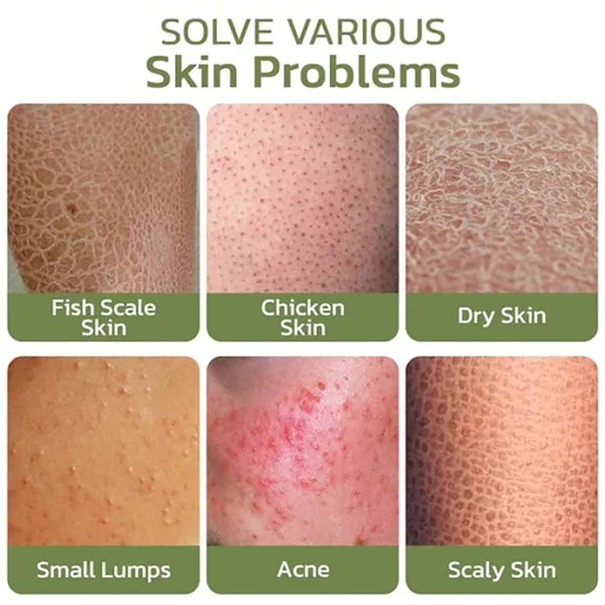 Hoddl Smooth Cream,Deeply Moisturize& smooth skin,for Rough and Bumpy Dry Skin (3Pcs)