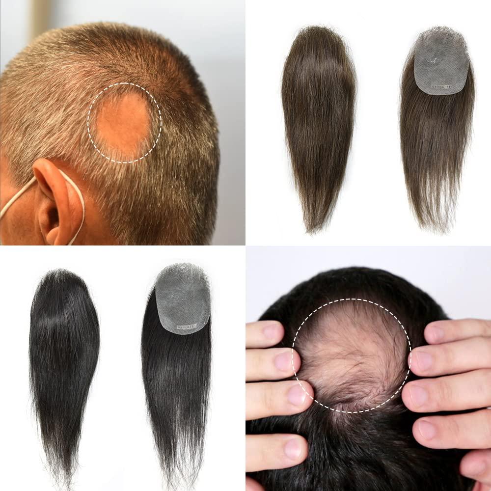 RESHE RESHE Bald Spot Hair Patch For Mens Toupee Transparent PU Skin V-Looped Hair Patches European Human Hair Topper Reaplcement Systems For Bald Spots Hairpiece (6cm X 8cm -16 INCH, 2 DARKEST BROWN)