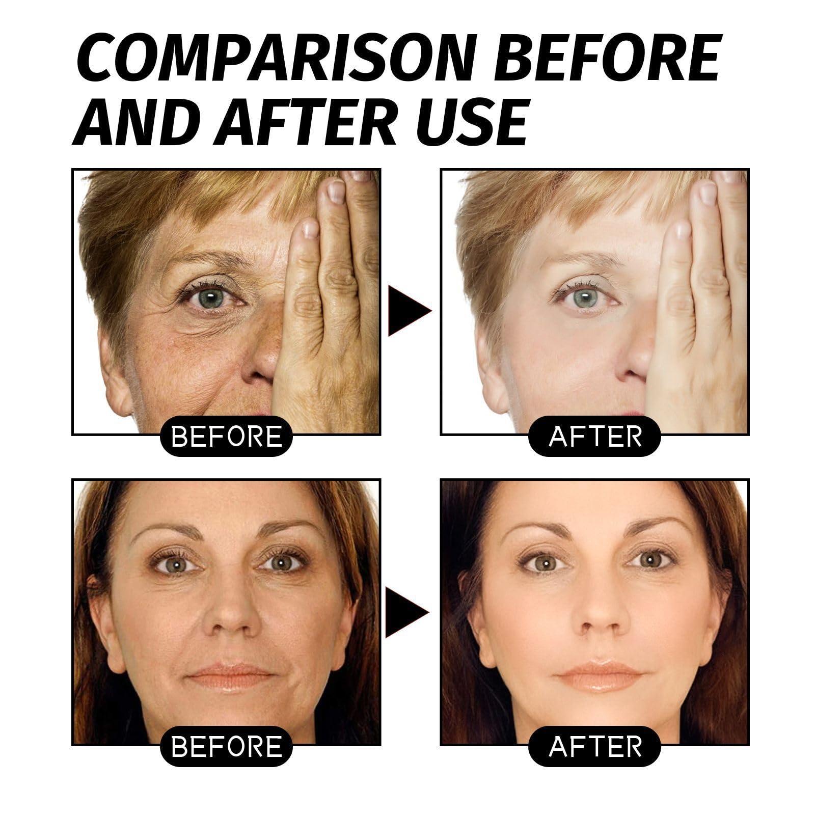 ATHNO Retinol Snake Venom Gold Mask,Retinol Snake Venom Peptide Gold Peel Off Mask,Rejuvenating Gold Peel off Mask,Anti Wrinkles&Reduce Fine Lines,Clear Acne & Blackhead,Moisturizing (7PCS)