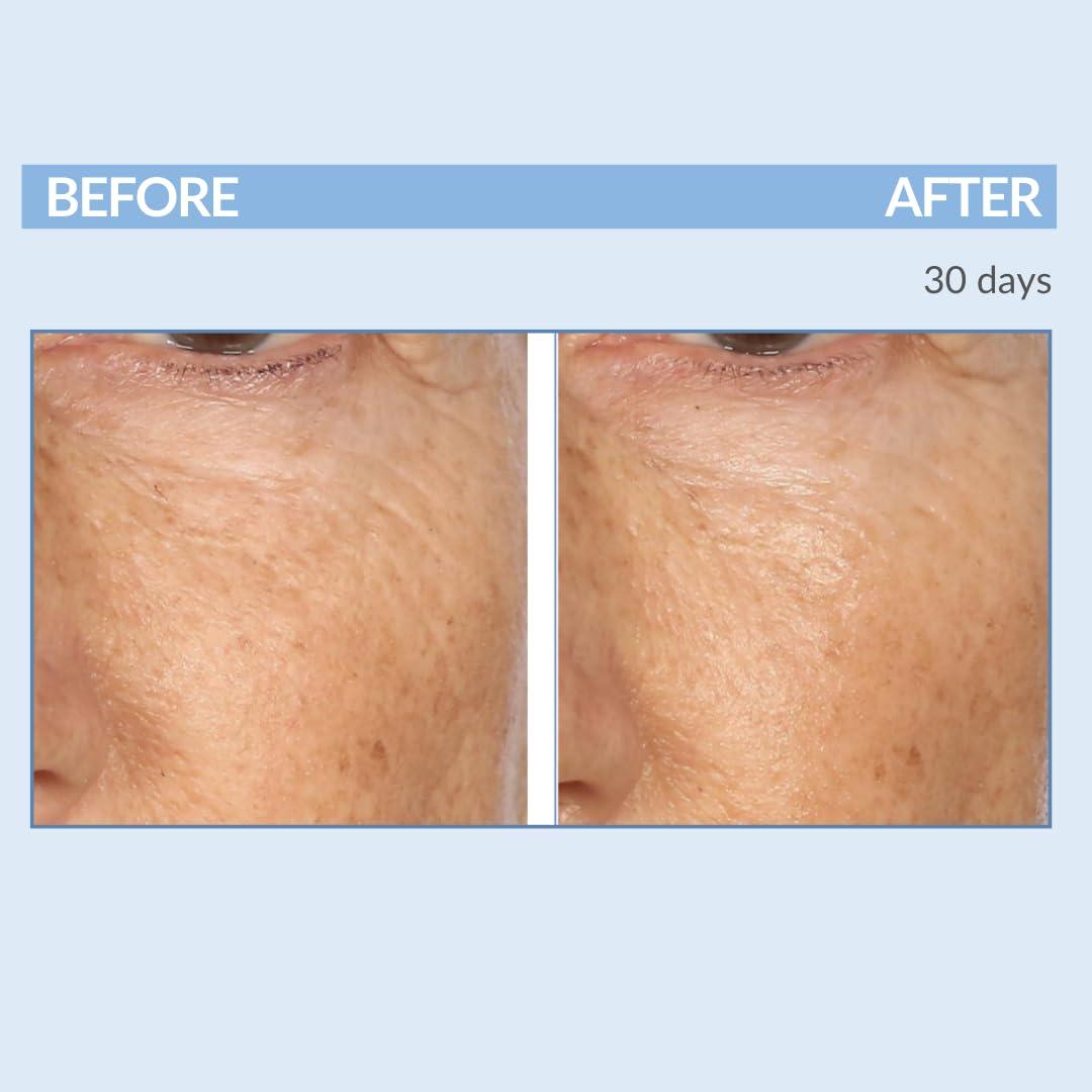 Serious Skincare Serious Skincare Retinol Facial Care DUO - A Force XR Serum Concentrate & A Cream XR Moisture Cream for Face - With Vitamin C - Anti-Aging for Lines, Wrinkles - Resurfaces and Hydrates Skin