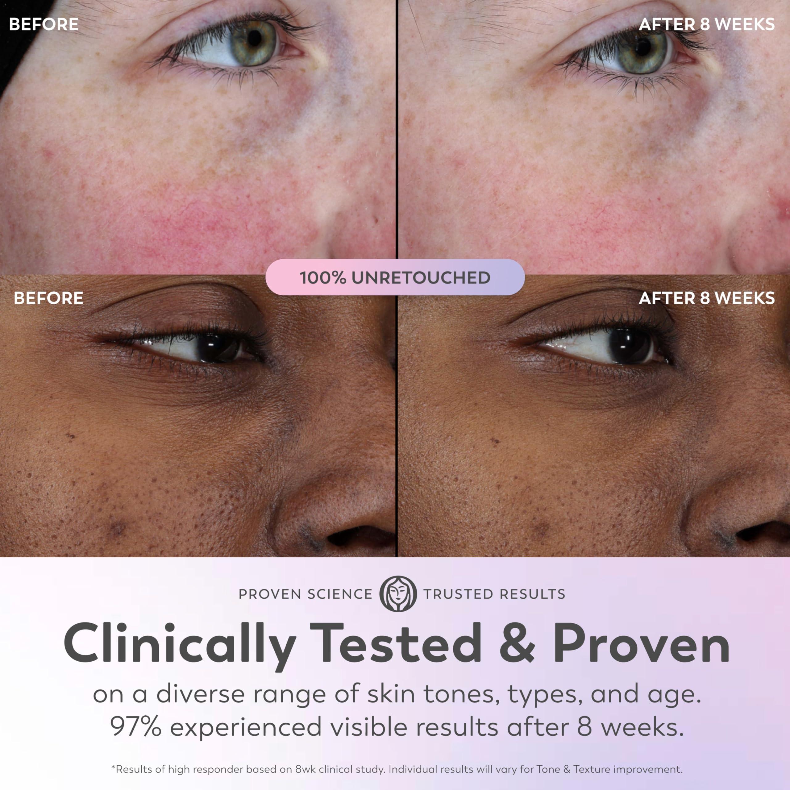 Olay Olay Super Serum - Vitamin C & E, Niacinamide, Collagen Peptide, AHA - Trial Size, Glass Skin Care for Face - Brightening, Hydrating, Firming, Evens Tone, Smooths Fine Lines, 0.4 Oz