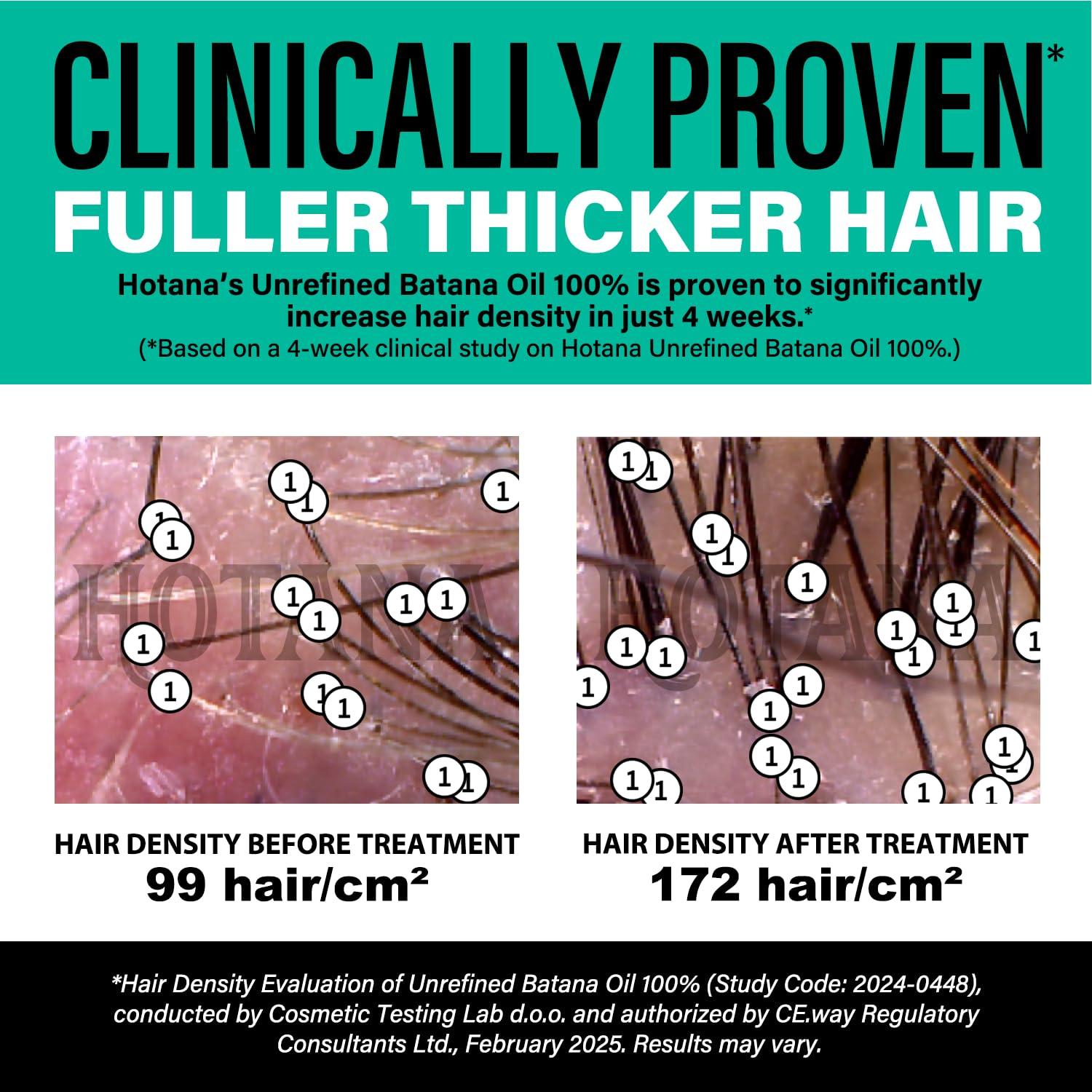 The-Mix-Up Unrefined Batana Oil for Hair Growth - Authentic & Organic Dr Sebi Batana Hair Mask from Honduras - Natural Hair Growth Oil - 4 Ounce Jar