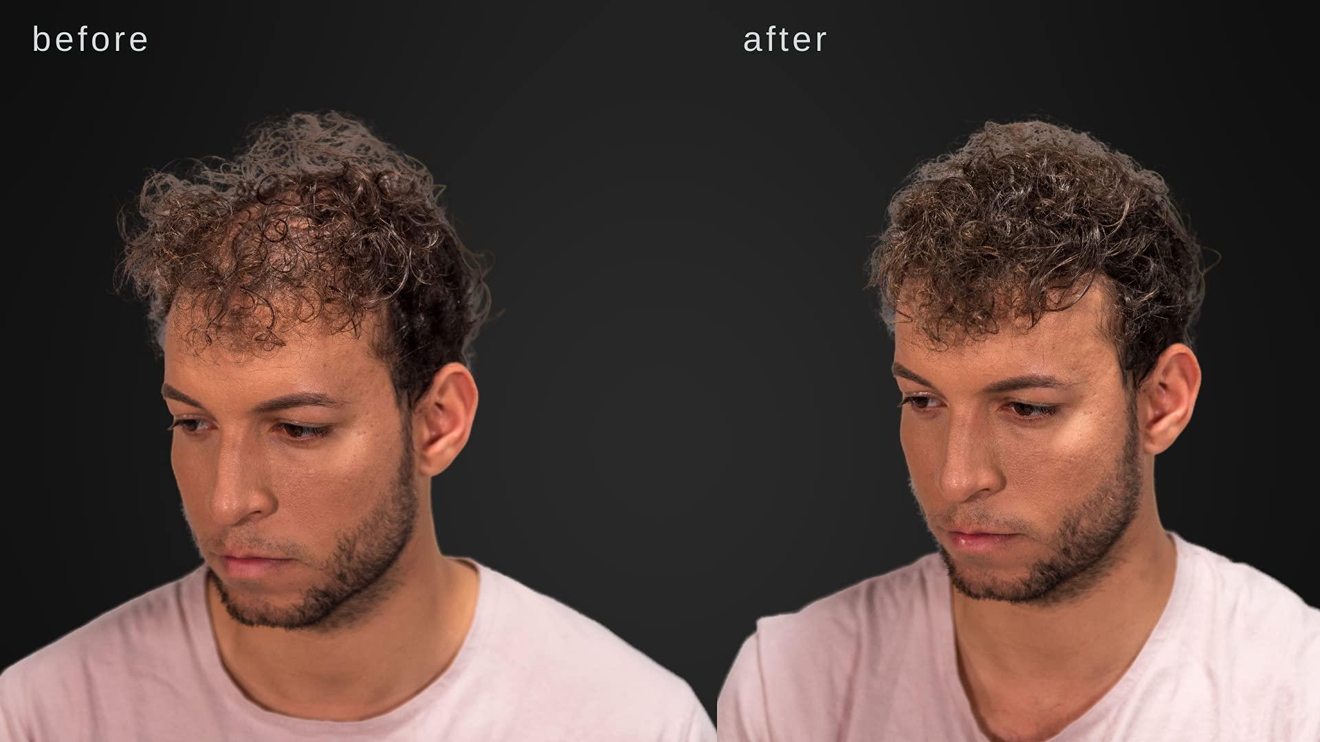 LUXE Professional LUXE Hair Thickening Fibers - CONFIDENCE IN A JAR – 2 Months+ Supply! – Hypoallergenic, Dermatologist Tested – Multiple Colors Available (Dark Brown)