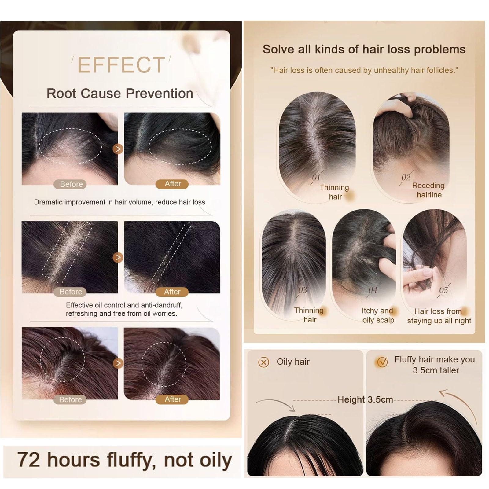 Nichalous 2PCS Ginger Plant Extract Anti-Hair Loss Hair Shampoo, Polygonum Black Ganoderma Extract Shampoo [2024 New Upgrade] (A (240mL+240mL/2Boxes))