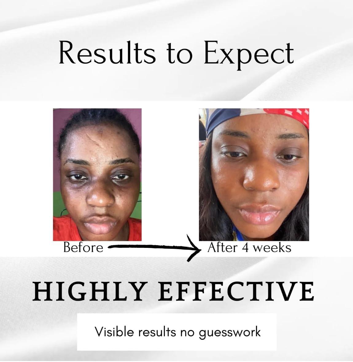 Unique Formulas Dark circles, Dark Under Eye Serum, Dark Circles Eraser serum 0.5 FL OZ