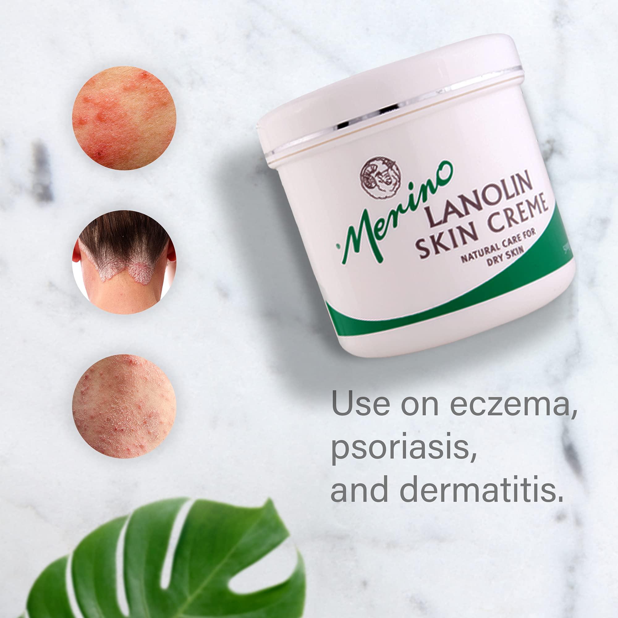 Merino Skin Care Dry Skin Lanolin Cream for Cracked Heels, Elbows and Soft Hands (500g/17.63 oz) Large Jar