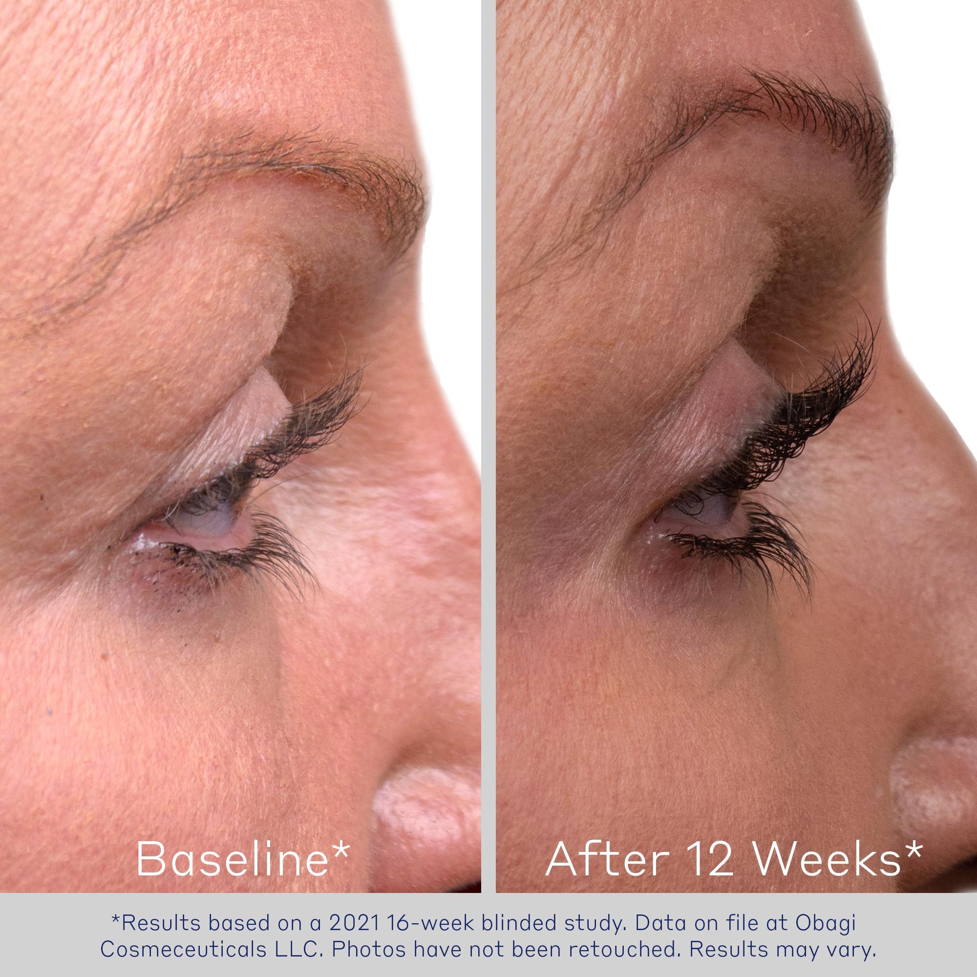 Obagi Medical Obagi Nu-Cil Eyelash Enhancing Serum Nourishing Lash Serum with Biotin for Thicker & More Defined-Looking Lashes 0.1 oz