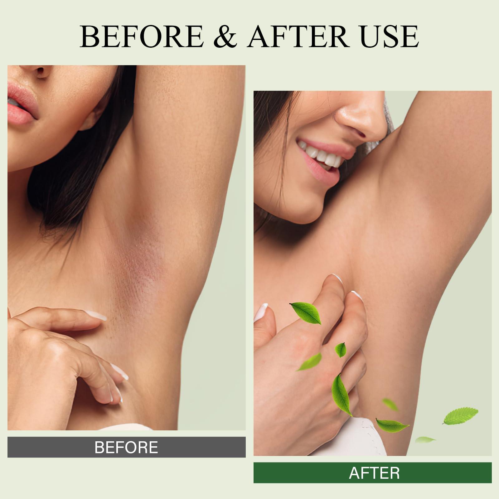 SHVYOG Underarm Detox Scrub, Green Tea Armpit Detox Scrub with Mint and Tea Tree, Natural Underarm Scrub for Armpit Detoxifying, Odors Eliminating, Exfoliating and Smoothing 8.11 Oz