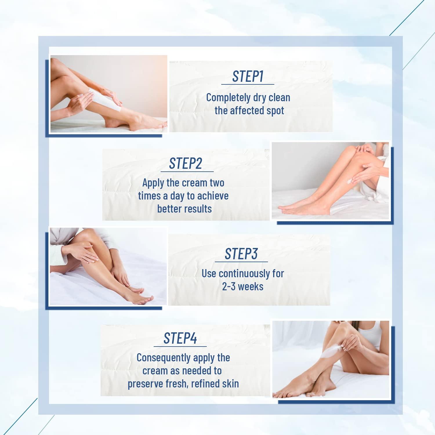 OUKEYA OUKEYA Urea Cream 40 Percent, Urea Foot Cream for Dry Cracked, 40 per Urea Lotion for Feet Maximum Strength (2 Packs)