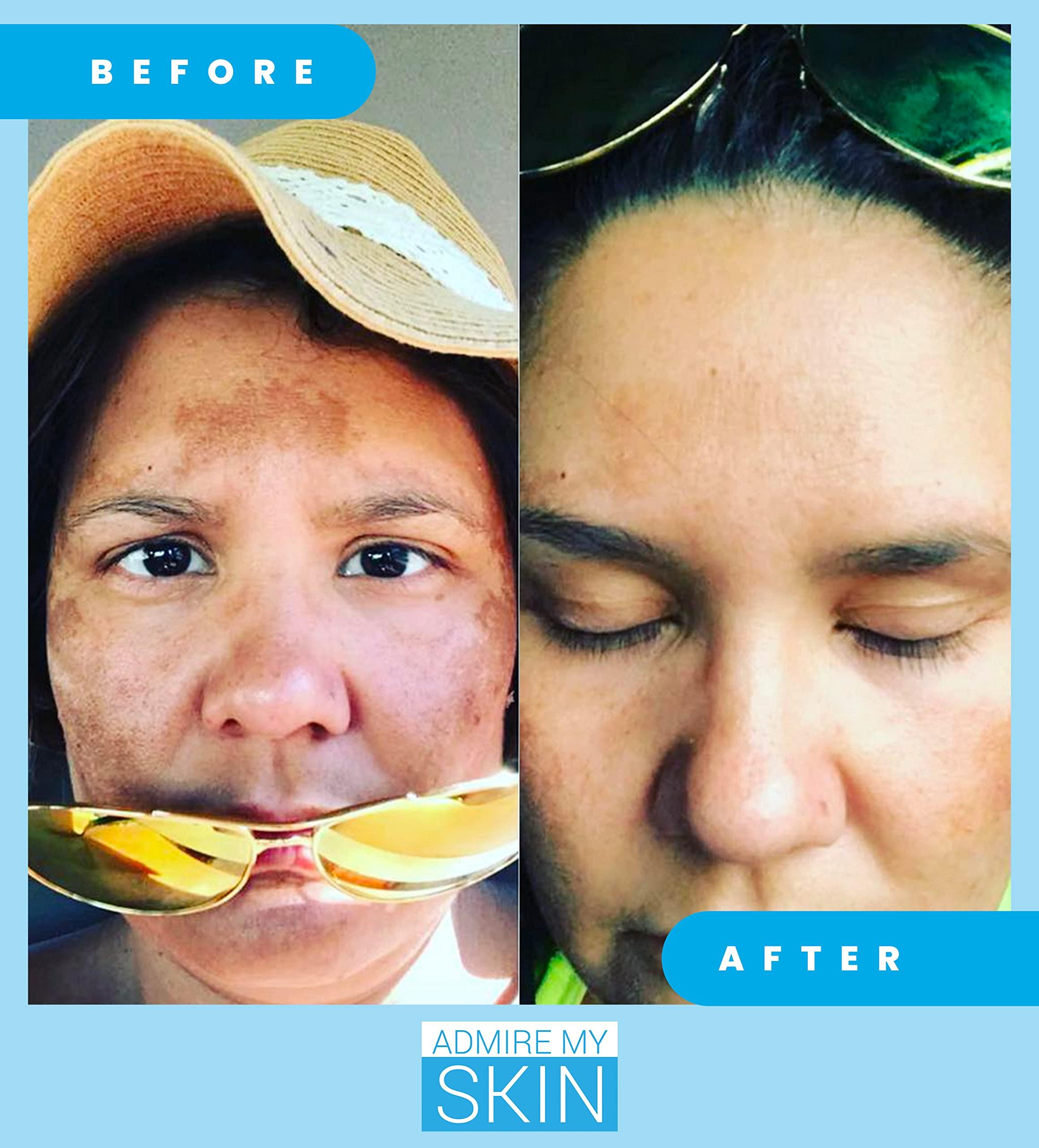 Admire My Skin Admire My Skin Dark Spot Corrector Serum + Retinoid Cream Set