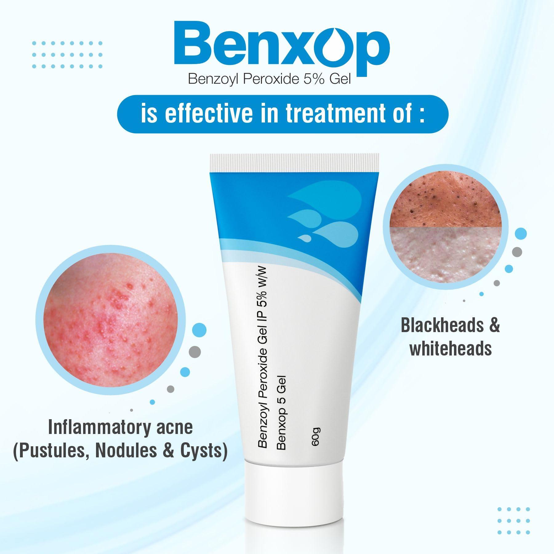 SALVE PHARMACEUTICALS PVT. LTD. Salve Benxop Benzoyl Peroxide 5% Gel for pimples, acne - 60 gm / 2.11 Oz