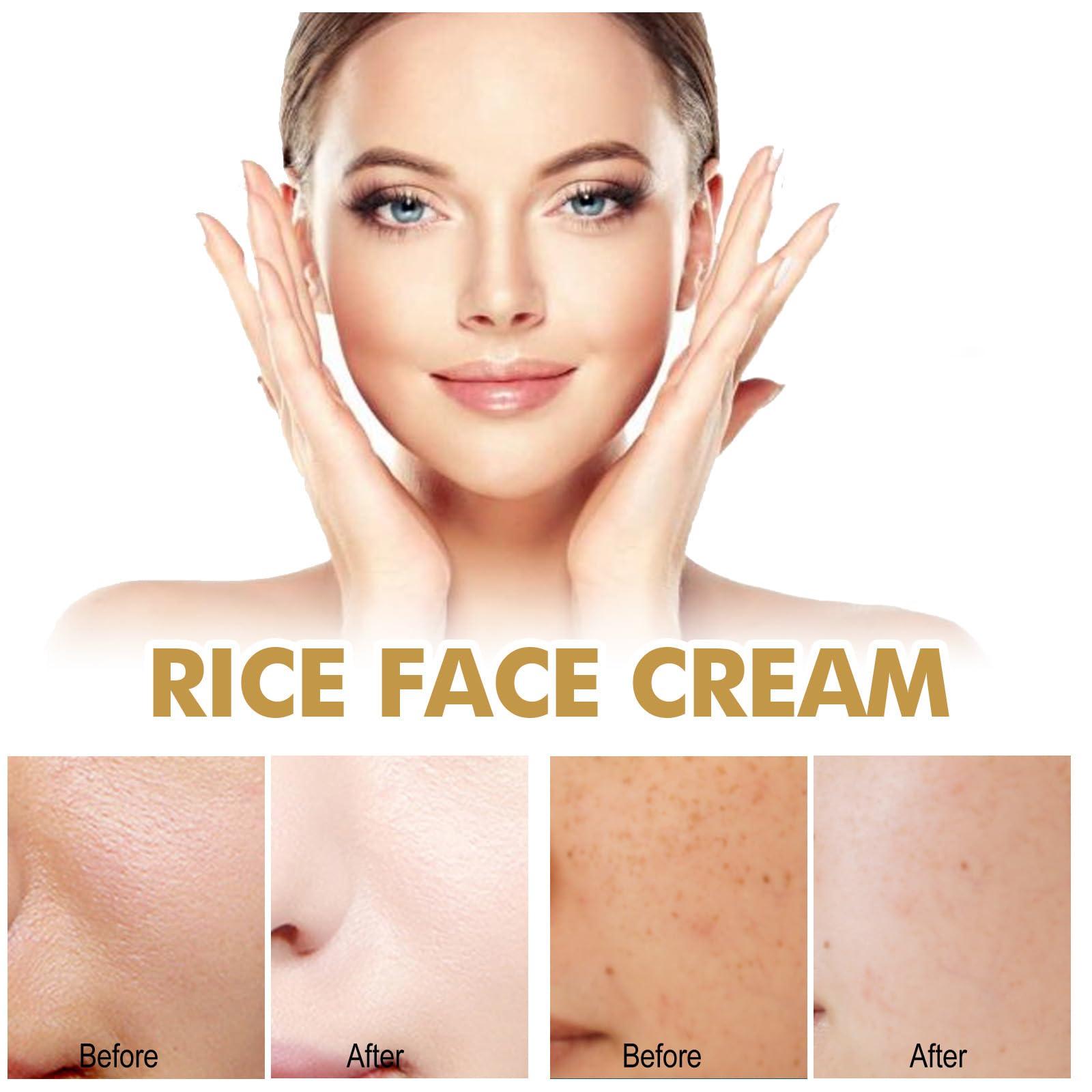 PEYNIR PEYNIR 1/2/3/5pcs crema de arroz para blanquear la piel,crema para las manchas de la cara,Cremas para Las Manchas de La Cara Oscuras, crema de arroz para la cara blanquear (2pcs,50ml)