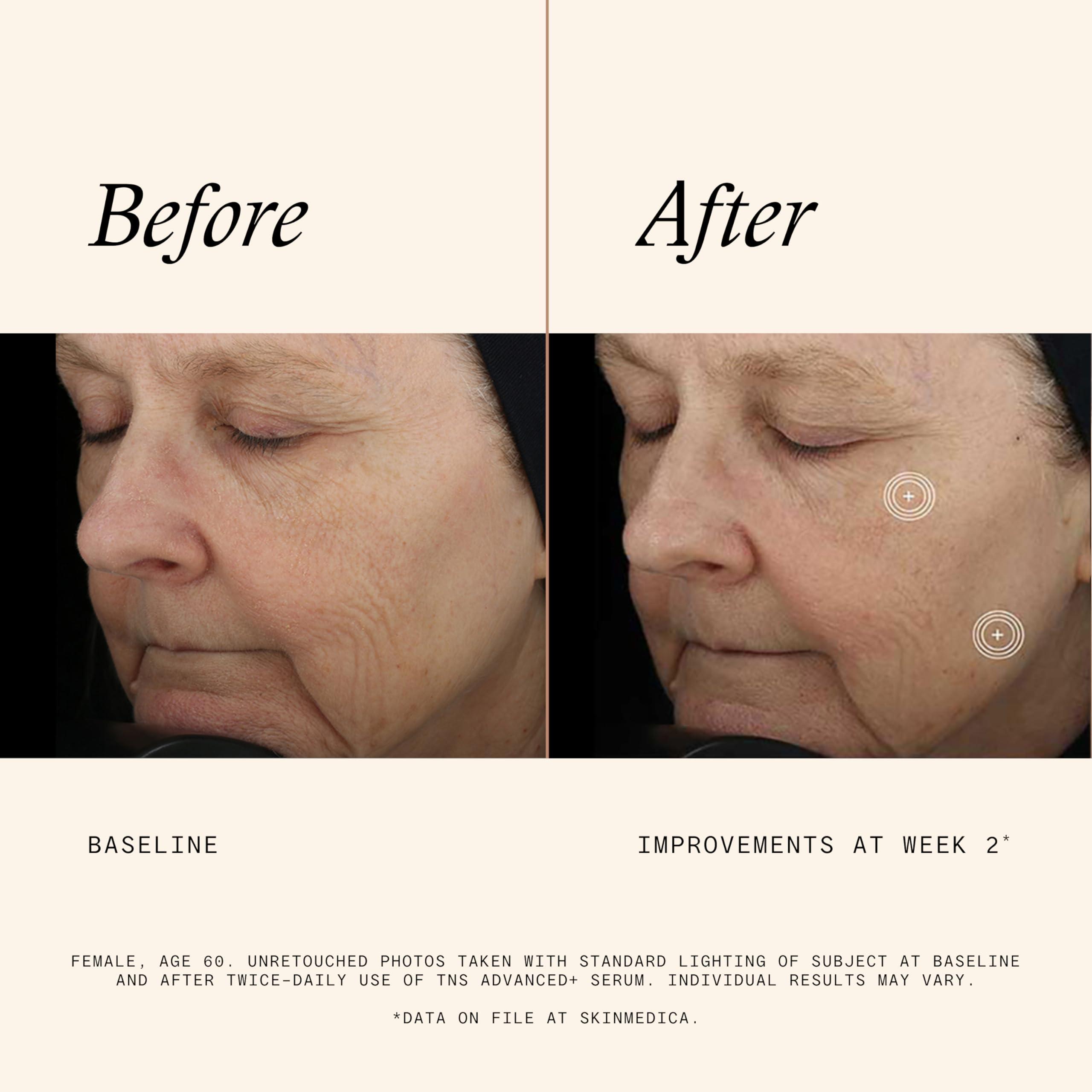 SkinMedica SkinMedica TNS Advanced+ Serum - Our Premium Facial Skin Care Product, the Secret to Flawless Skin. Age-Defying Face Serum for Women is Proven to Address Wrinkles and Fine Lines for Glowing Skin,1 Oz