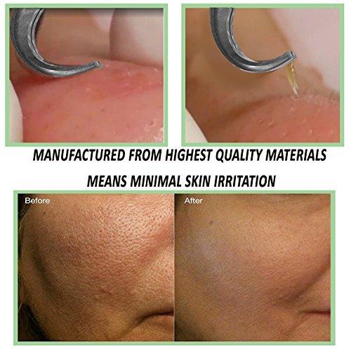 FEITA Blackhead Remover Kit - FEITA Blackhead Tweezers Removal Tool Kit Set - Acne Tweezers Pimple Comedone Extractor With Travel Case (5 Pcs)