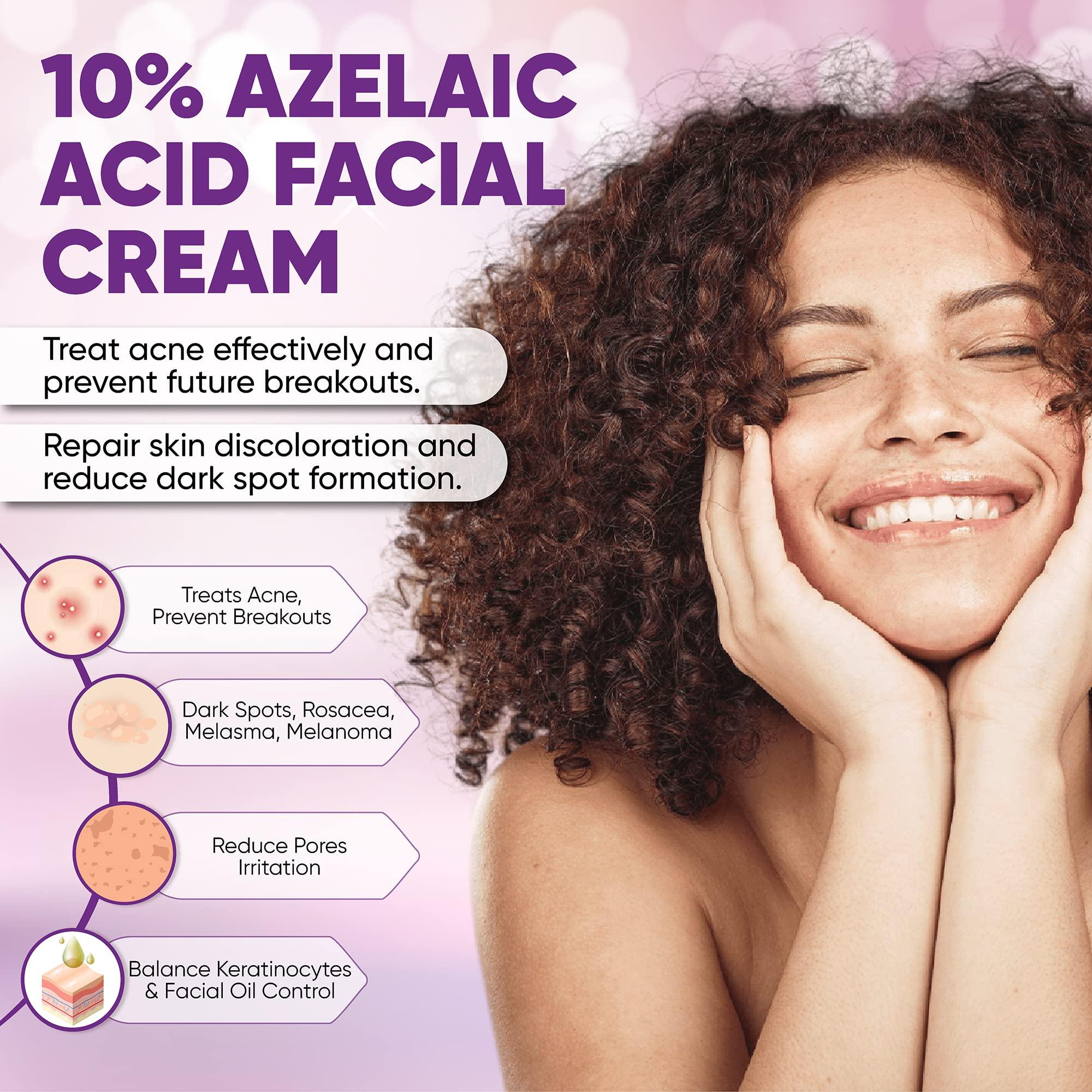 AOBBIY 10% Azelaic Acid Cream: Acne Treatment - Acne Cream - Redness Relief for Face - Redness Reducing Skin Care , Fix Discoloration, Prevent Breakouts, Enhance Skin Tone 1 OZ (2 PACK)