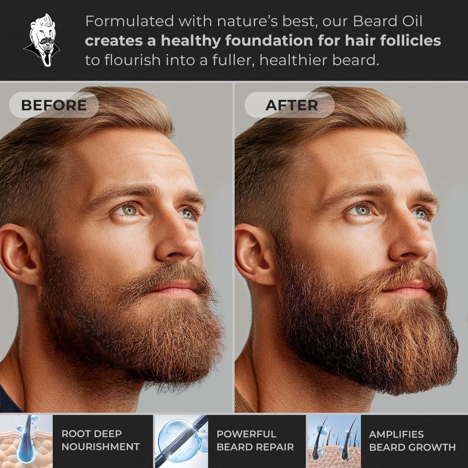 ManBeast ManBeast Beard Oil for Men - Beard Growth Oil, Hypoallergenic Beard Oil, Nut Free Beard Oil Mustache Growth Oil, Beard Oil and Conditioner for Men Made From Seed Based Oils - Lion\'s Den Beard Oil 30ml