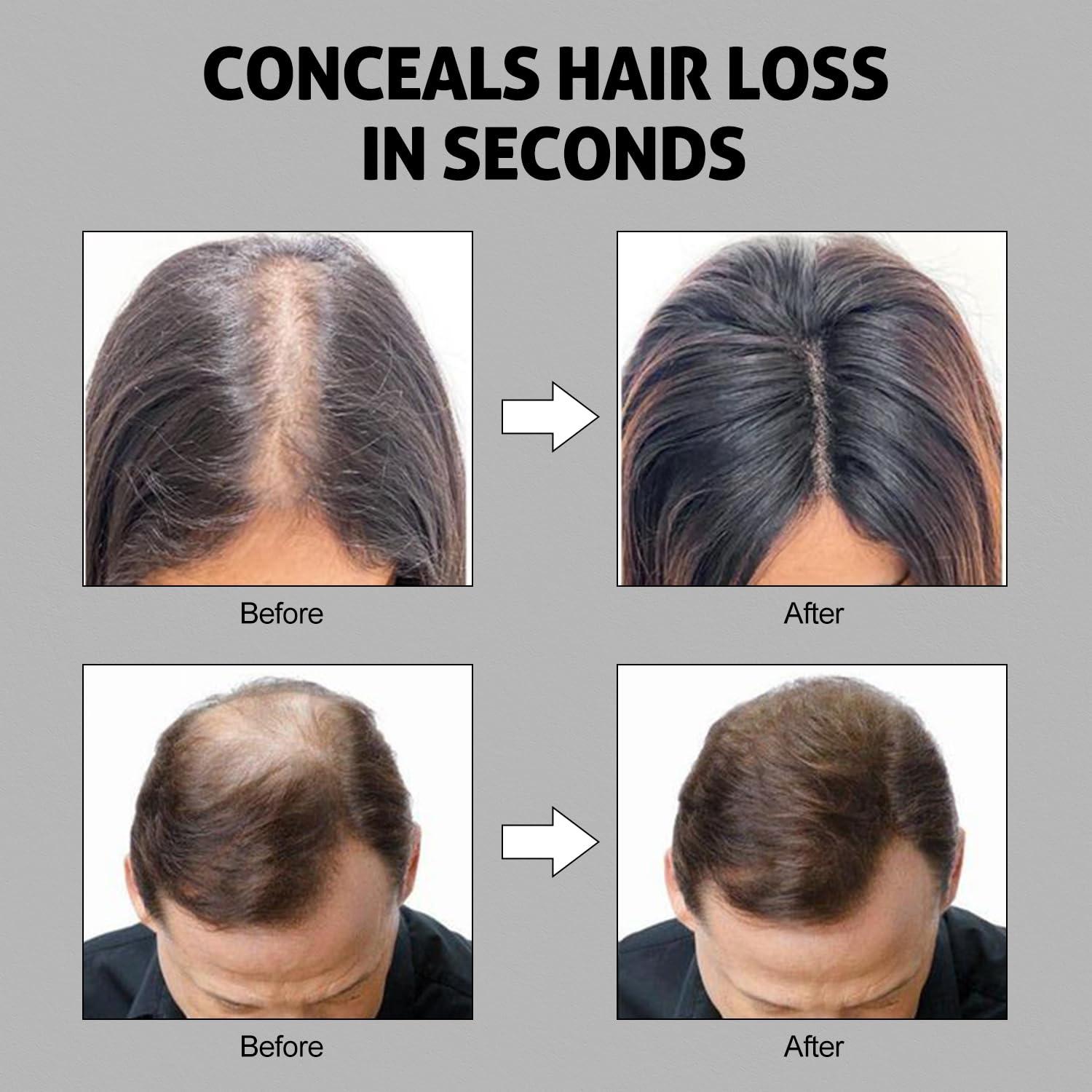 Ustar Ustar Hair Building Fibers for Thinning Hair 27.5g Light Brown Conceals Hair Loss Instantly Thicker Fuller Look 9 Shades for Women & Men