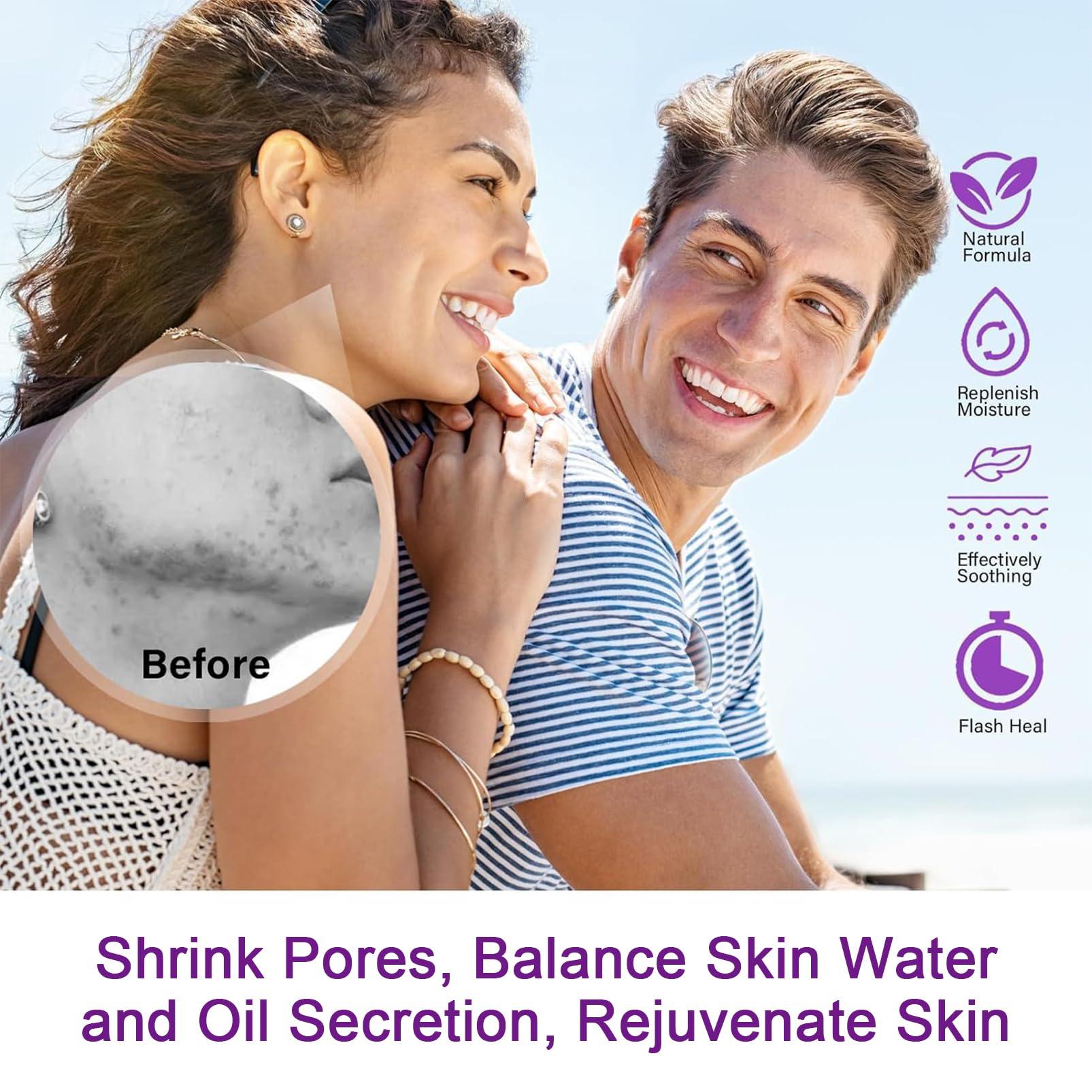 ISHERBIN Azelaic Acid Serum, Booster 12% Azelaic Acid Cream, Niacinamide & Vitamin C for Face, Facial Cream, Balance Excess Sebum,Smoothing Skin and Blemish,Pore Cleansing 1pcs