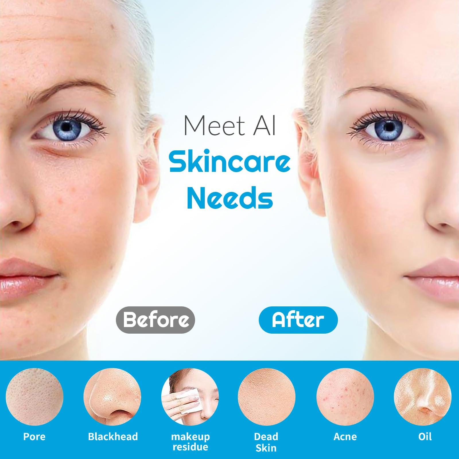 Landmore Landmore Silicone Face Scrubber, Waterproof Facial Cleansing Brush with Red Light Thermal Massage, Electric Face Scrubber with Nose Scrubber Exfoliator for Women/Men Deep Cleansing, Power Exfoliating