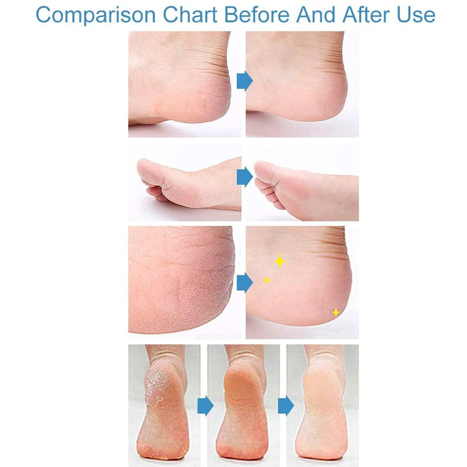 Panasonic Panasonic ER240B Beard & Mustache Trimmer for Men