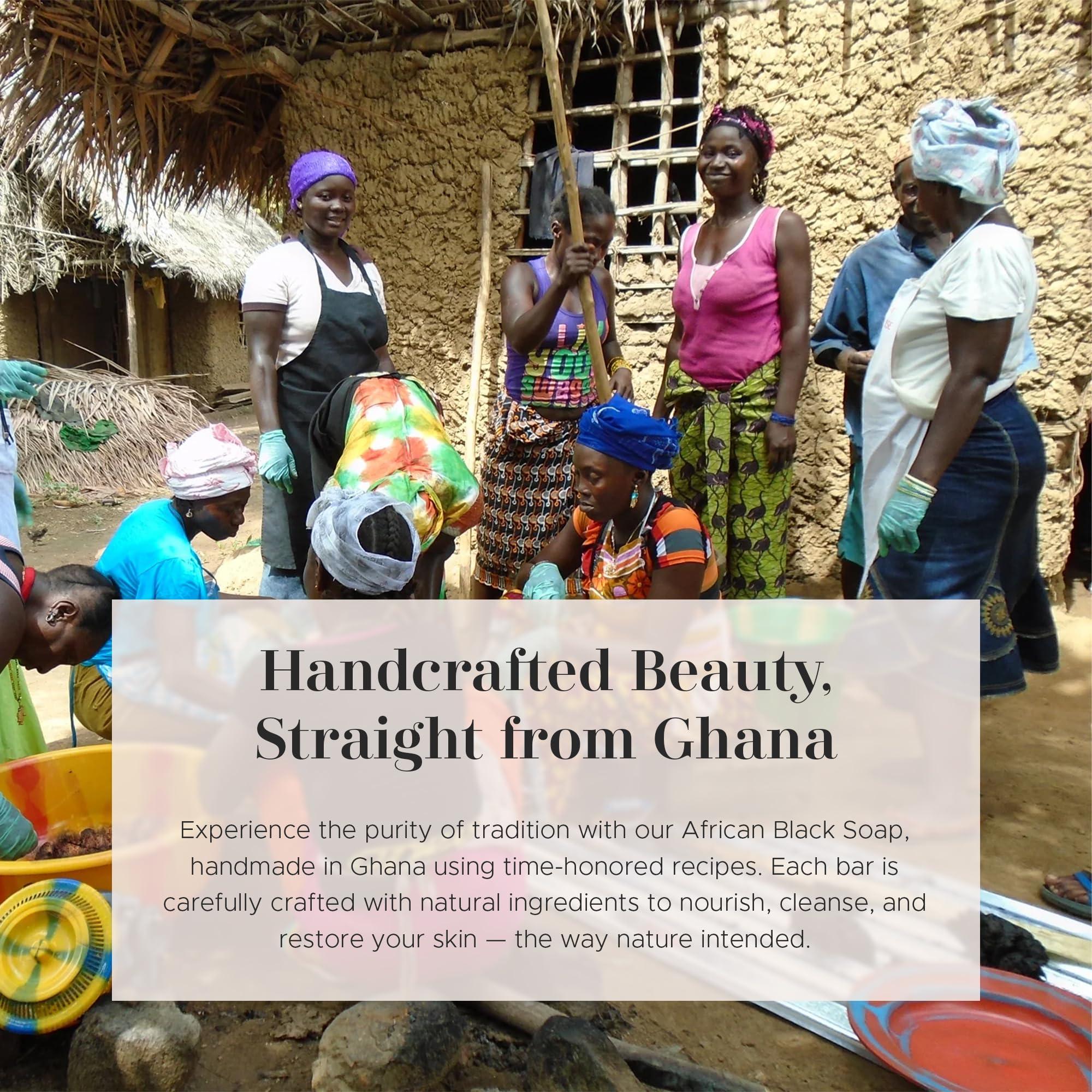 era of nature era of nature Best Raw ORGANIC AFRICAN BLACK SOAP, for Dry Skin and Skin Conditions. Pure & Natural Ingredients, Imported From Ghana - 1lb (16oz)