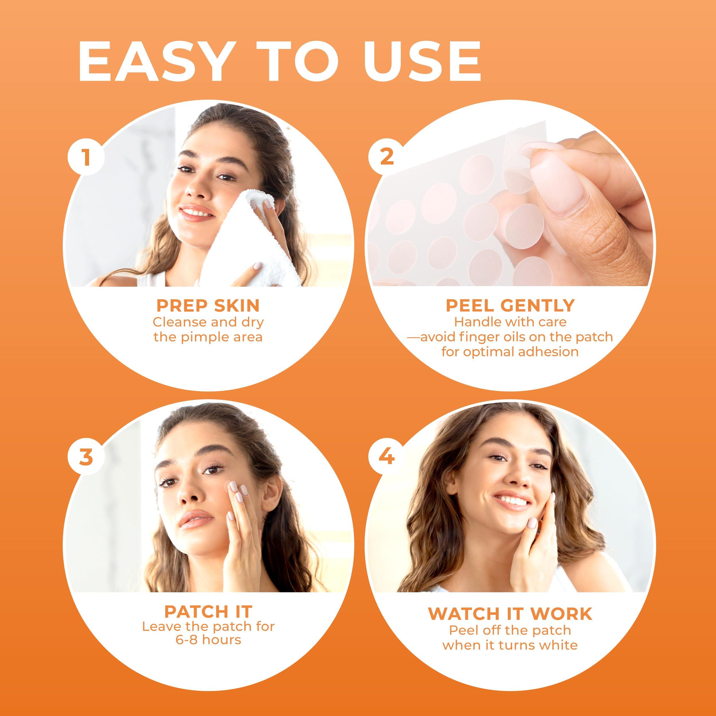 KEYCONCEPTS PatchRx Pimple Patches for Face (240 Patches), Hydrocolloid Acne Patches, Pimple Patch Pimple Stickers, Hydrocolloid Patch Acne Dots Acne Pimple Patches For Face, Zit Patches, Acne Spot Treatment