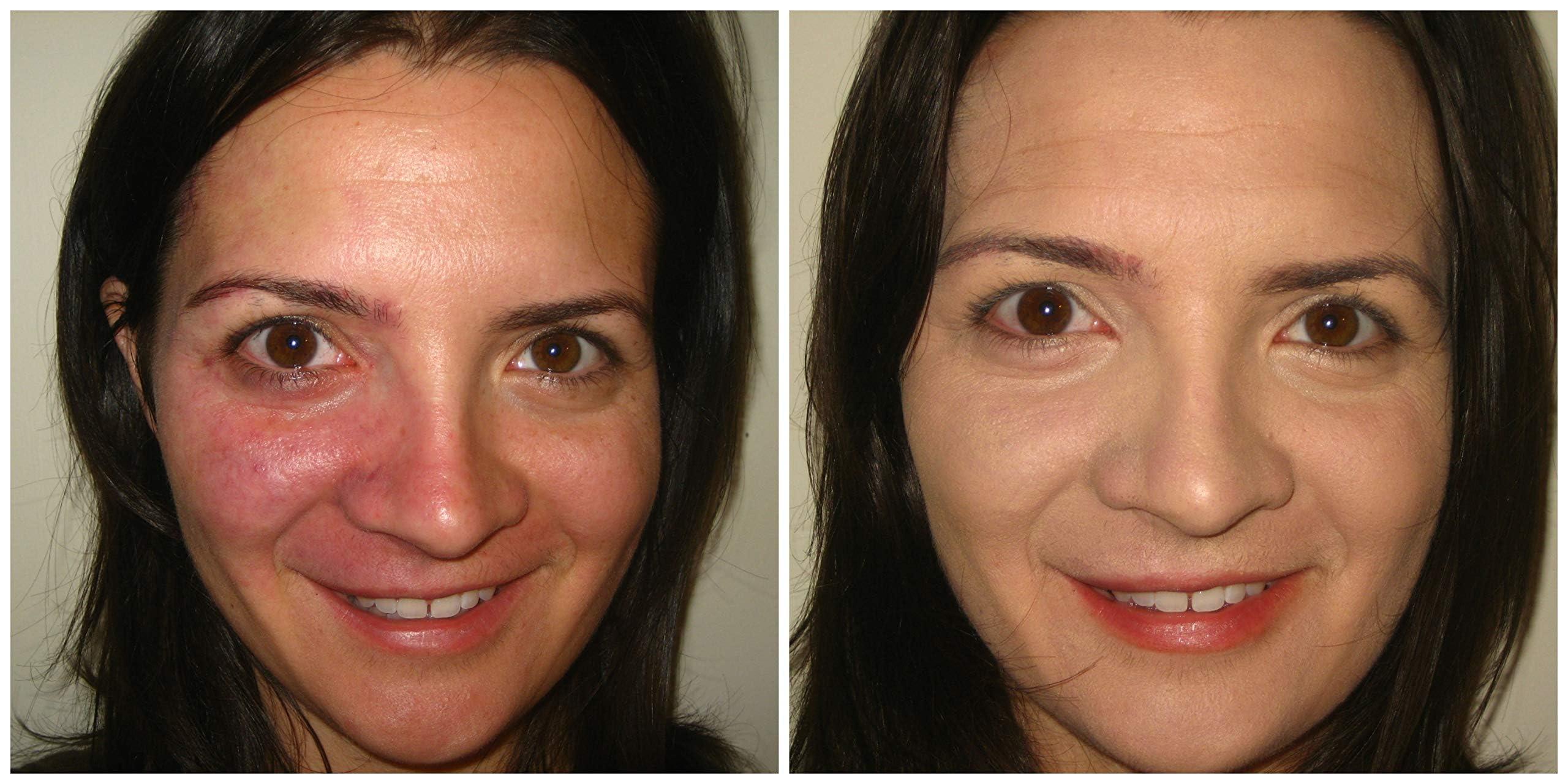 Judith August Judith August Killer Cover - Light/Medium - Cover Bruises, Tattoos, Age Spots, Vitiligo & More