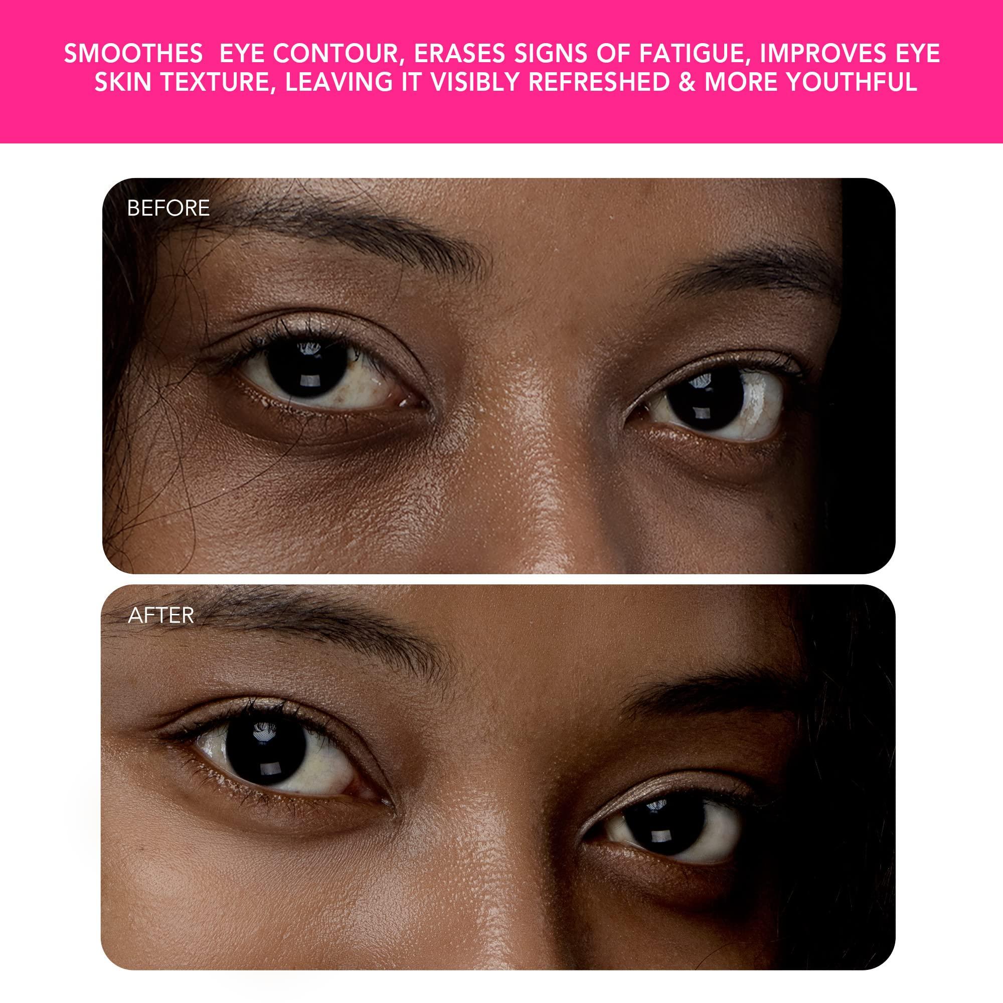 FOREO FOREO IRIS 2 Lymphatic Drainage Eye Massager | Dark Eye Circle Remover & Eye Bags Remover | Enhanced Under Eye Cream Absorption | Anti Wrinkle Eye Puffiness Reducer | 2-year Warranty | Fuchsia