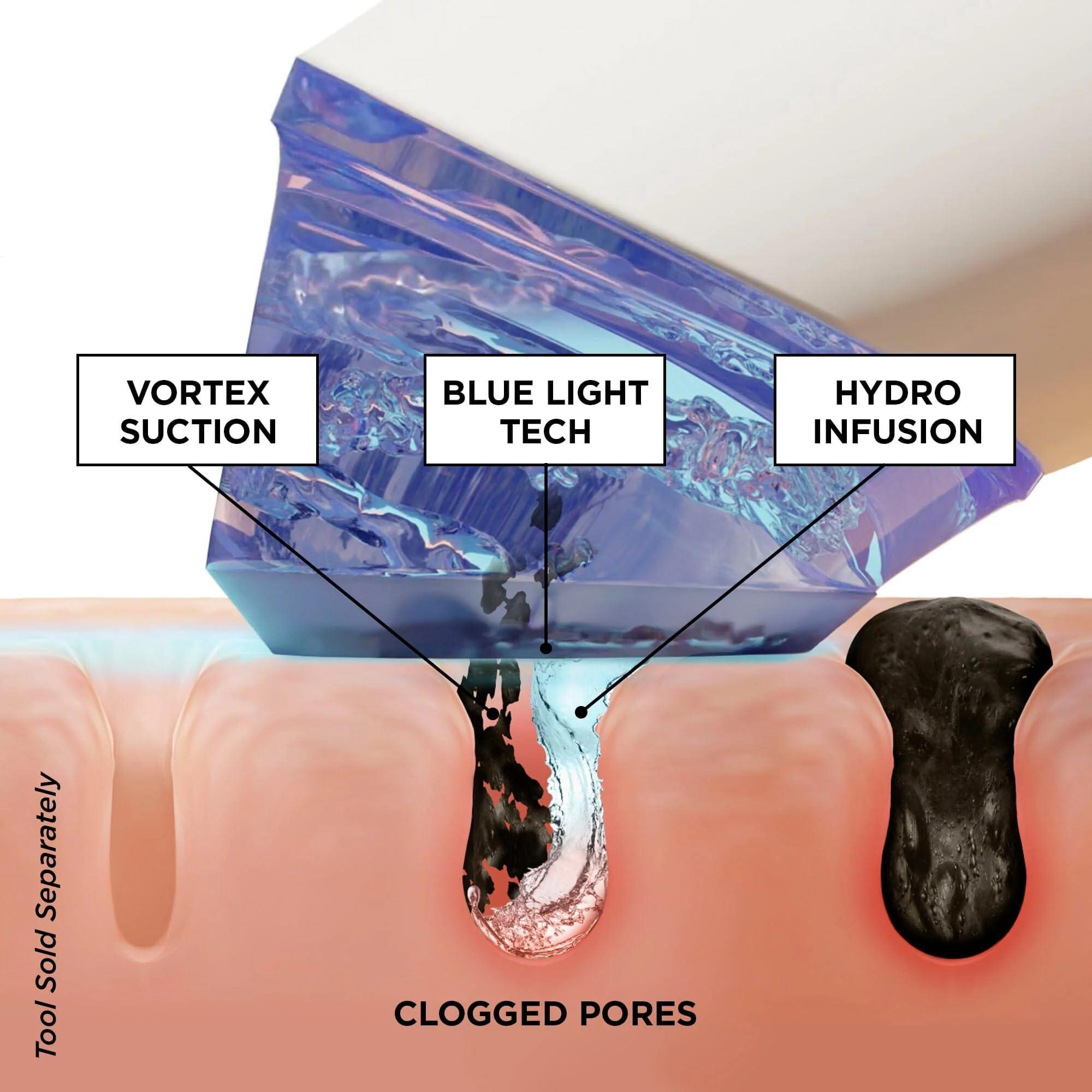 beautybio BeautyBio GLOfacial Hydro-Infusion Deep Pore Cleansing + Blue LED Clarifying Tool & Concentrates