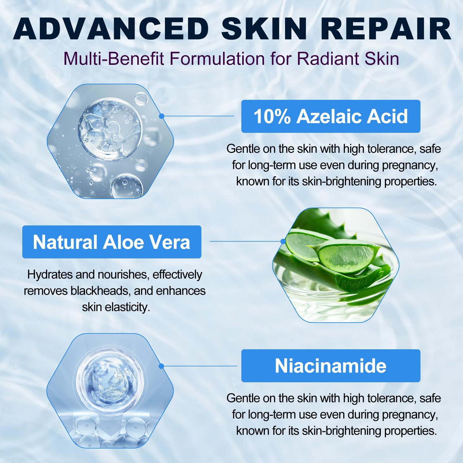 Netwik 10% Azelaic Acid Cream for Face - Acne Cream for Rosacea Reducing Relief Pimple Breakouts Blackhead Pigmentation and Redness - Azelaic Acid Gel For Facial and Skin Care