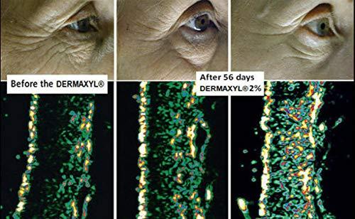 Bellahut Skin Care DER-MAX-YL (Palmitoyl Hexapeptide-12) - Mix in with your favorite cream, gel, lotion or serum to make your own skin care solution. FOR THE REDUCTION OF DEEP WRINKLES, CROWS FEET AND UNDER THE EYES (10 ml)