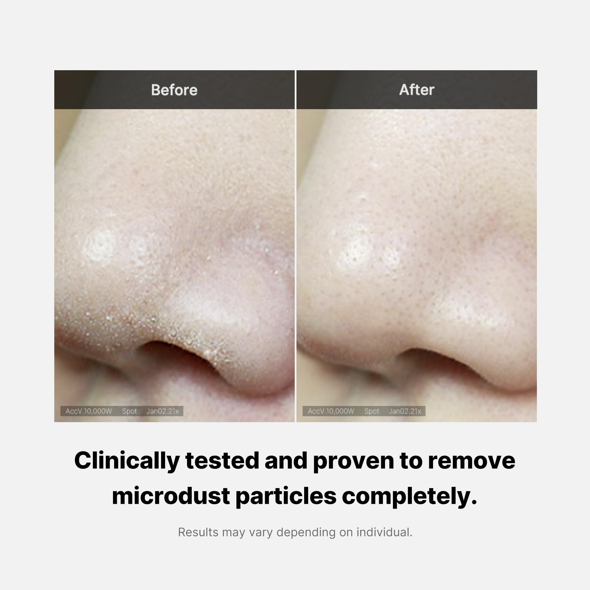 Medicube Medicube Zero Foam Cleanser for Sensitive Skin - Sebum Control, Moisture Balance, and Pore Minimization | Korean Skincare