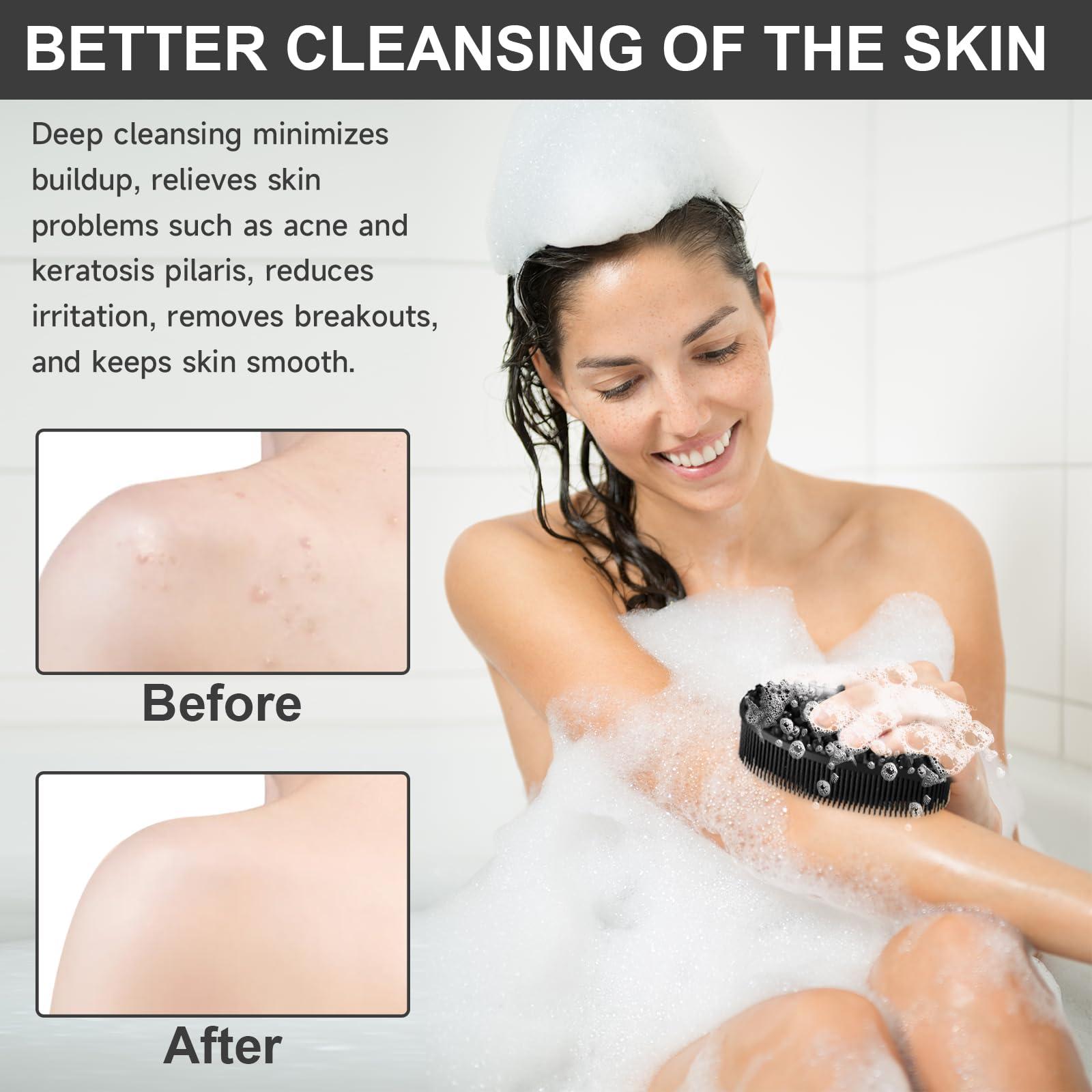 Metene Metene 2 Pack Silicone Exfoliating Body Scrubber with Loop, Body Scrubber for Men and Women, Silicone Loofah for Shower, Soft Silicone Body Scrubber for Shower and Bath Skincare Routine(Black)