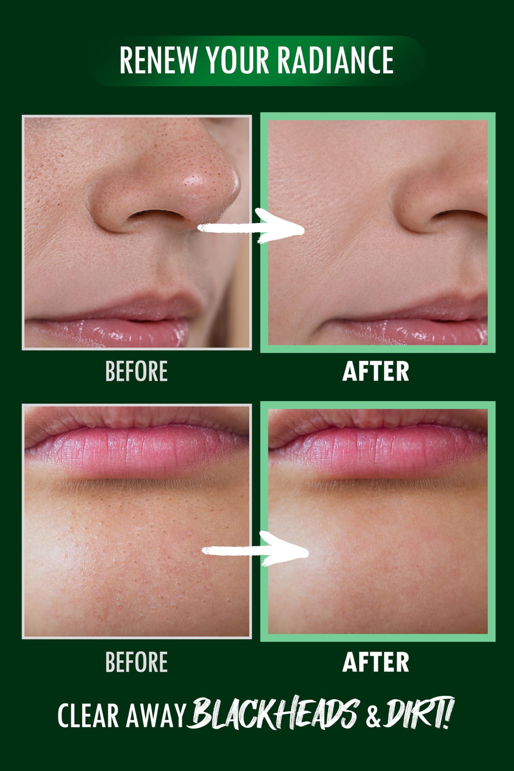 DERMALOGY by NEOGENLAB [K-Beauty] Neogen Dermalogy Pore Zero Peeling Mousse | All-in-One Foaming Exfoliating Face Wash Visibly Firming, Tightening & Lifting Skin 3.38 fl oz