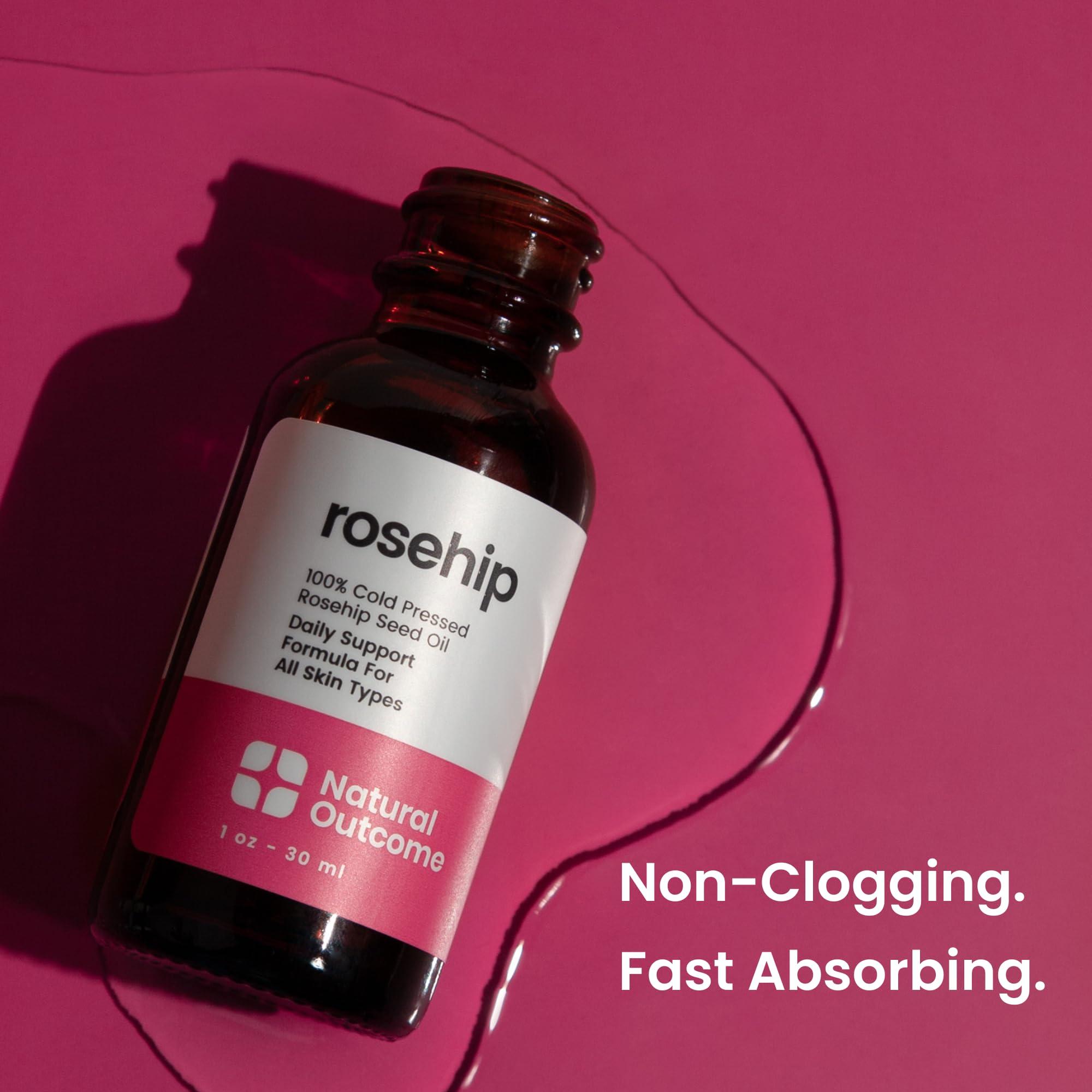natural outcome natural outcome Rosehip Oil 100% Pure Cold-Pressed Rosehip Seed Face Oil - Anti-Aging Facial Oil to Plump, Balance & Hydrate 1 oz
