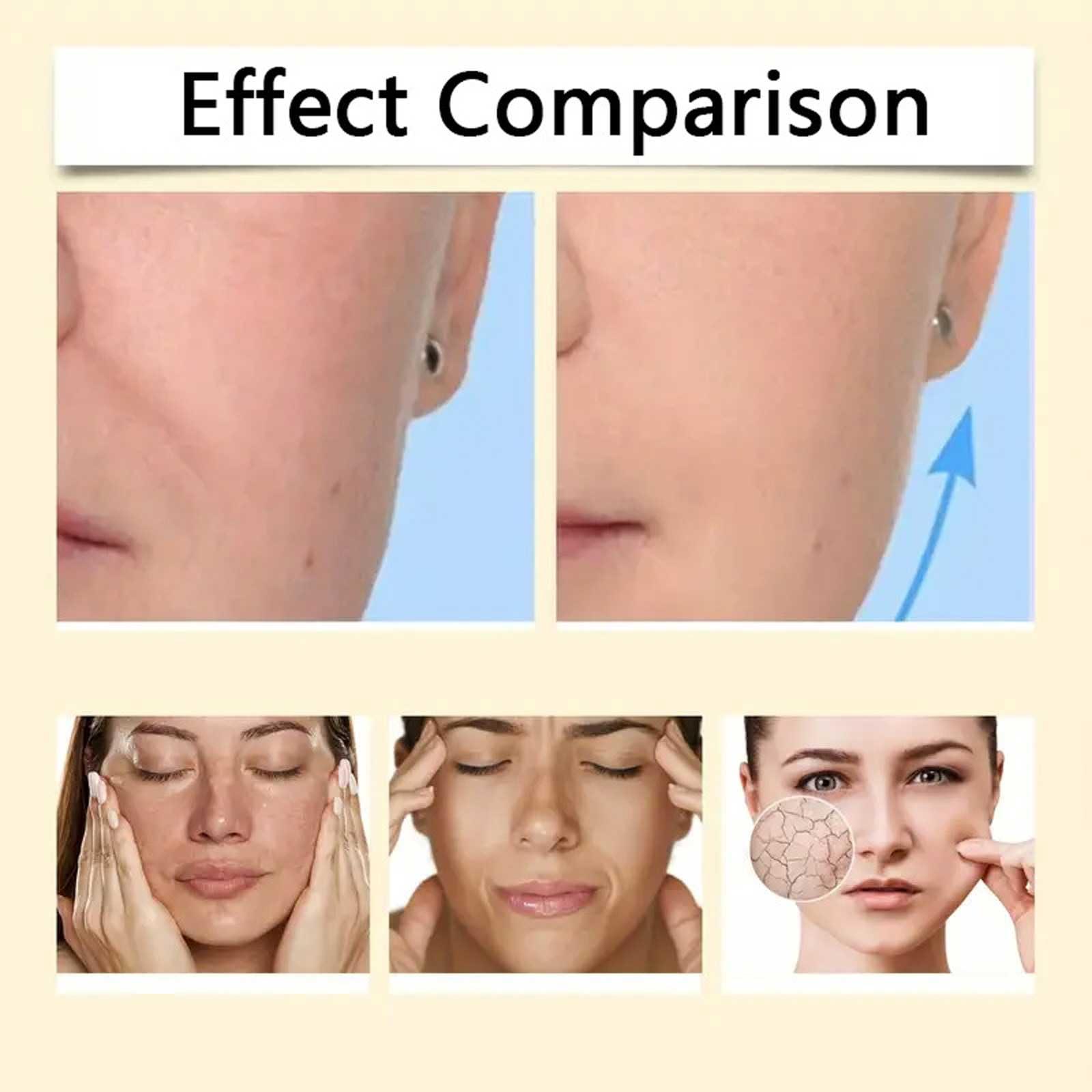 Generic Bee Venom Wrinkle Removal Cream, Bee Venom Cream For Wrinkles, Bee Venom Cream, Bee Venom Firming Cream, Bee Venom Anti-Wrinkle Firming Cream, Bee Venom Moisturizer-Cream (90ml)