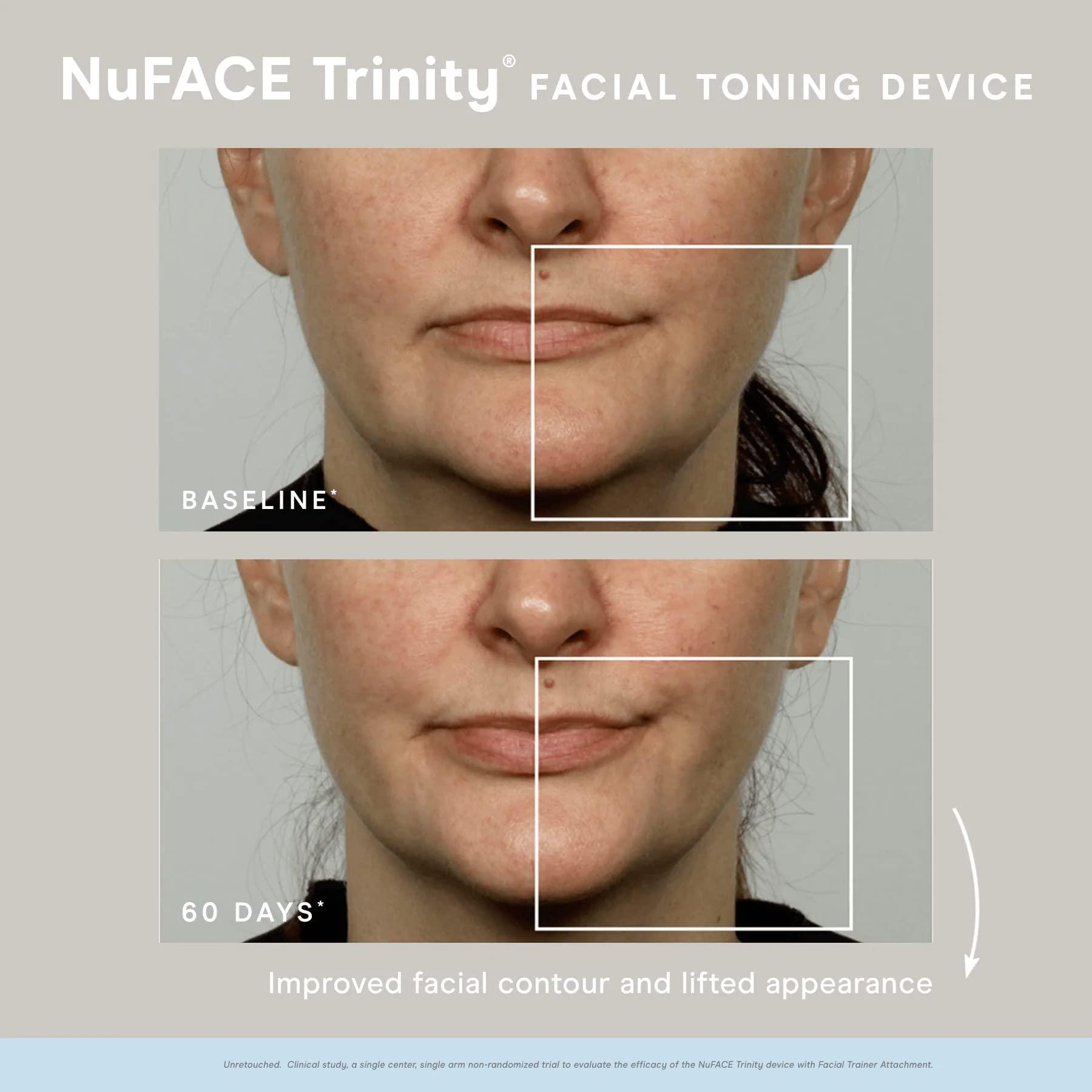 NuFACE NuFACE Trinity Microcurrent Facial Device Kit - FDA Cleared Face Sculpting & Neck Tightening Device to Contour Cheeks & Brows + Microcurrent Gel Activator, Silk Crme & Brush