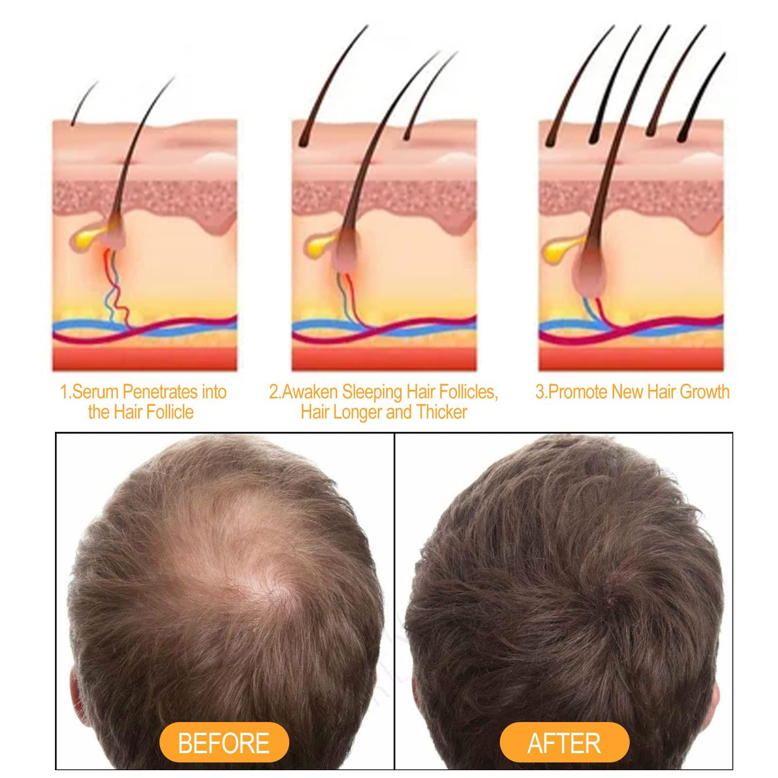 QINGTING 500ml Instant Ginger Hair Regrowth Shampoo, Ginger Shampoo, Ginger Shampoo for Hair Growth, Ginger Shampoo Hair Thickening Shampoo, Anti-Hair Loss (Shampoo)