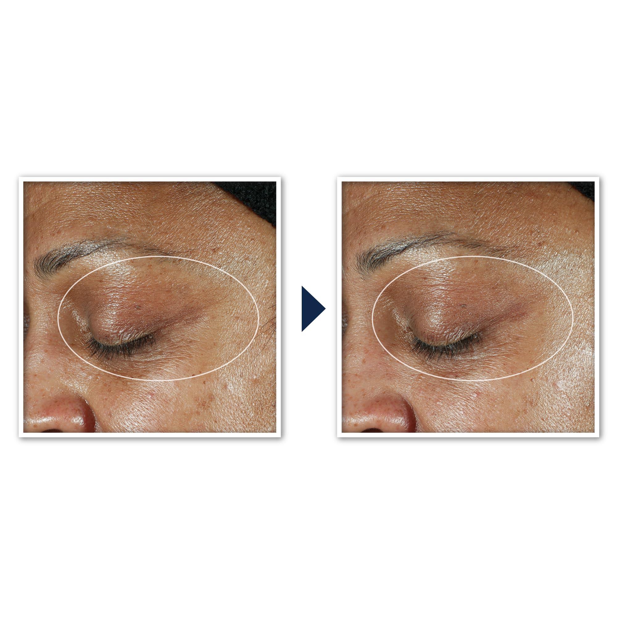 RoC RoC Multi Correxion 5 in 1 Anti-Aging Eye Cream for Puffiness, Under Eye Bags & Dark Circles, Skin Care Treatment with Shea Butter, (.5 oz) with Night Cream Packette (Packaging May Vary)