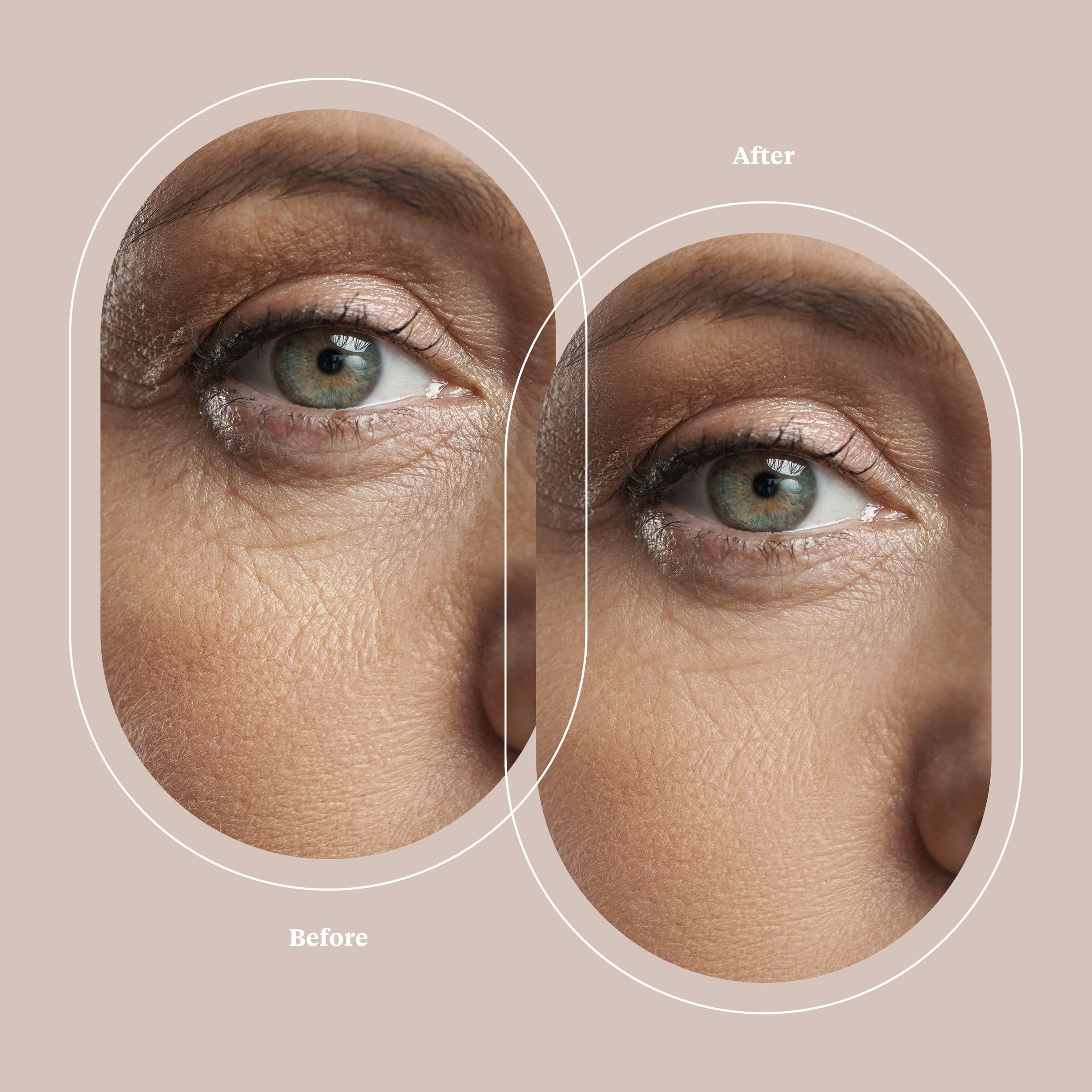 Trophy Skin Trophy Skin UltradermMD - 3 in 1 Home Spa Microdermabrasion - Deep Skin Exfoliator Machine with Real Diamond and Pore Extractor Tips - Rejuvenate Face Skin and Even Out Skin Tone - Blush